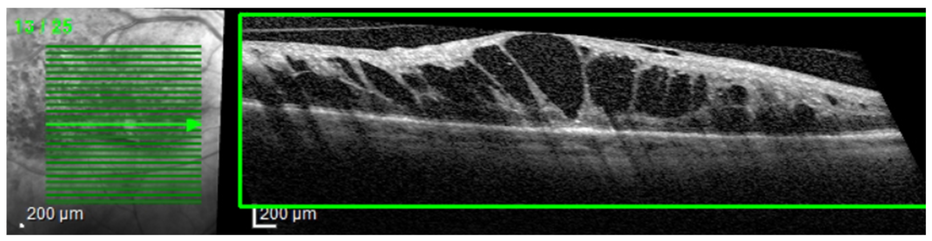 Diagnostics 14 00076 g002