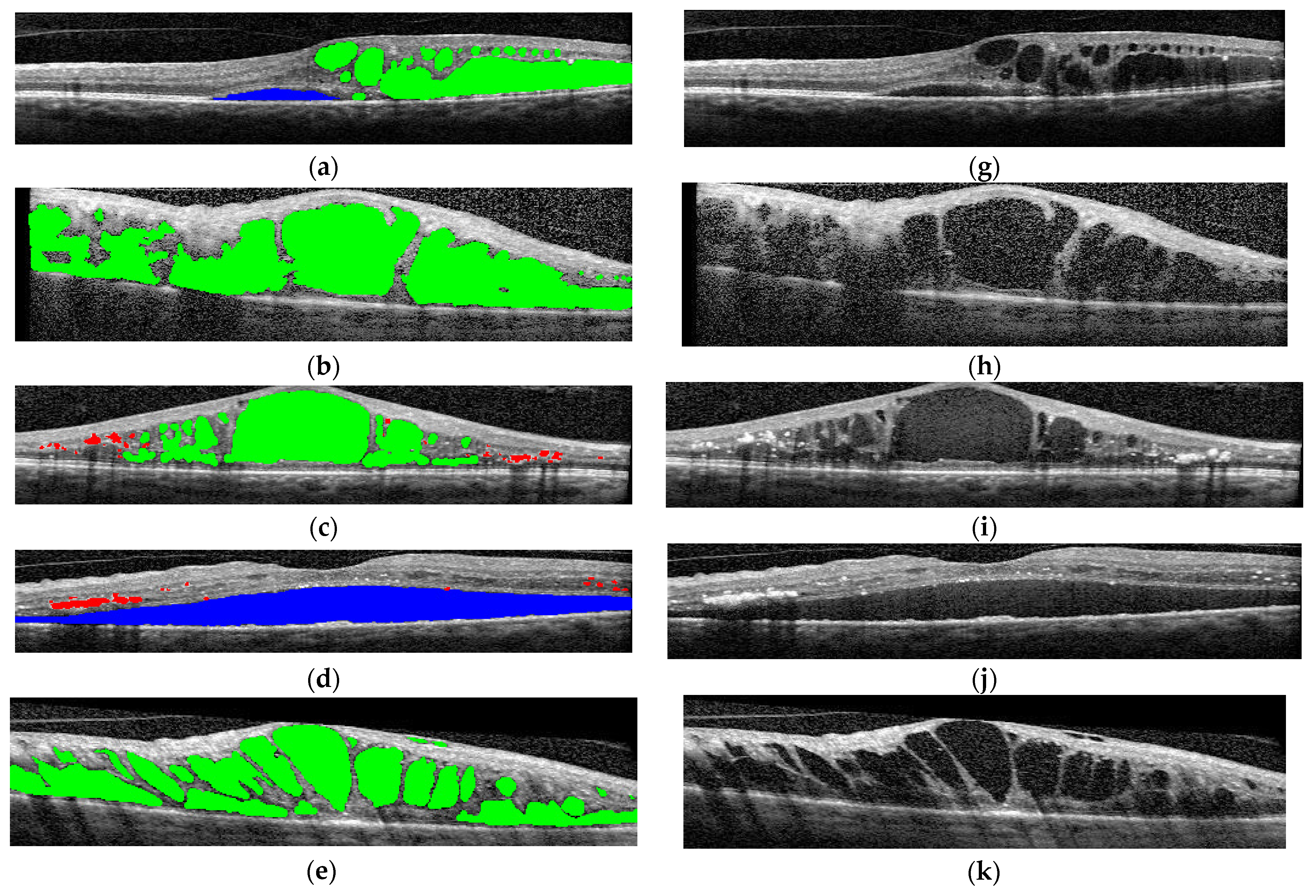 Diagnostics 14 00076 g004a