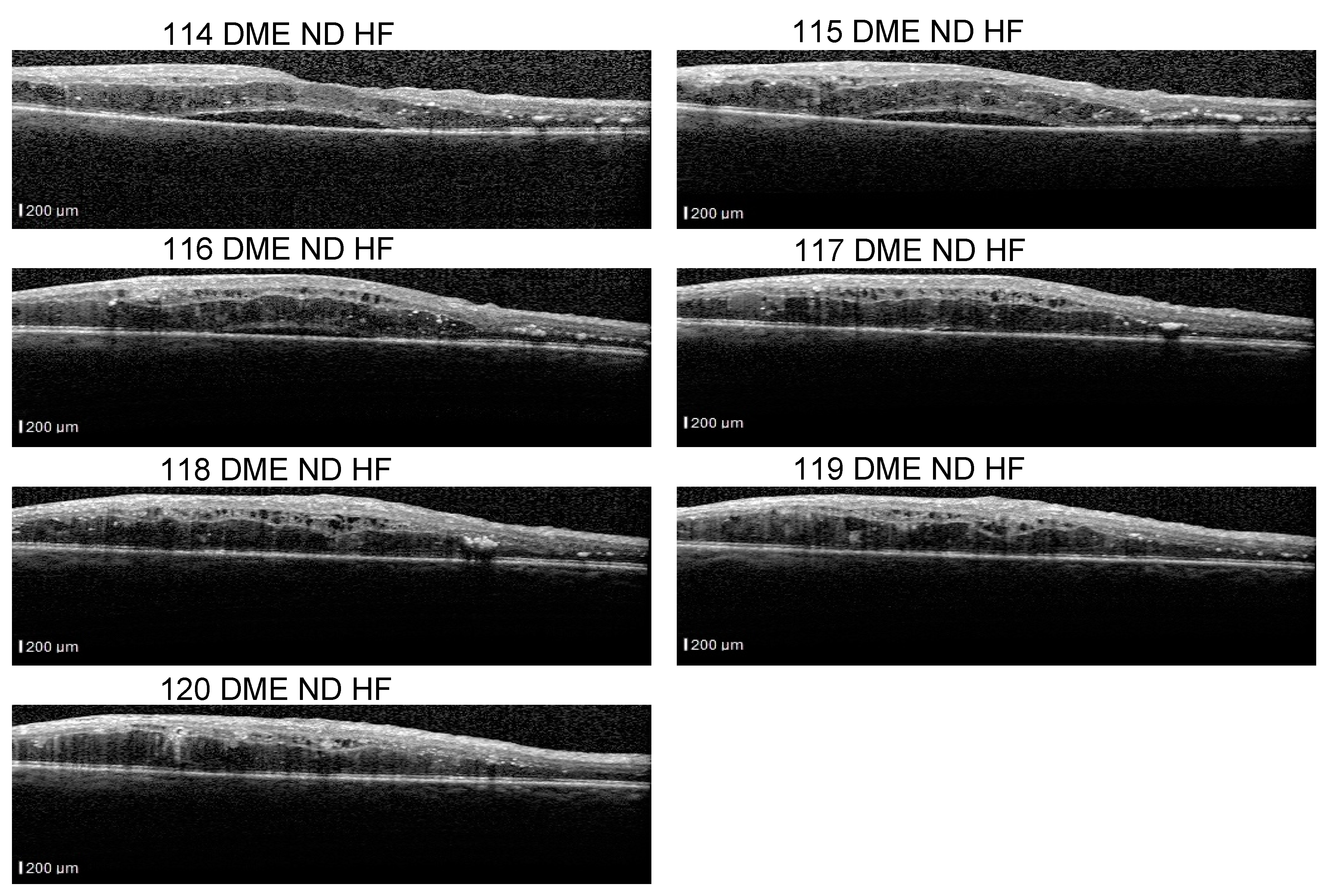 Diagnostics 14 00076 g011