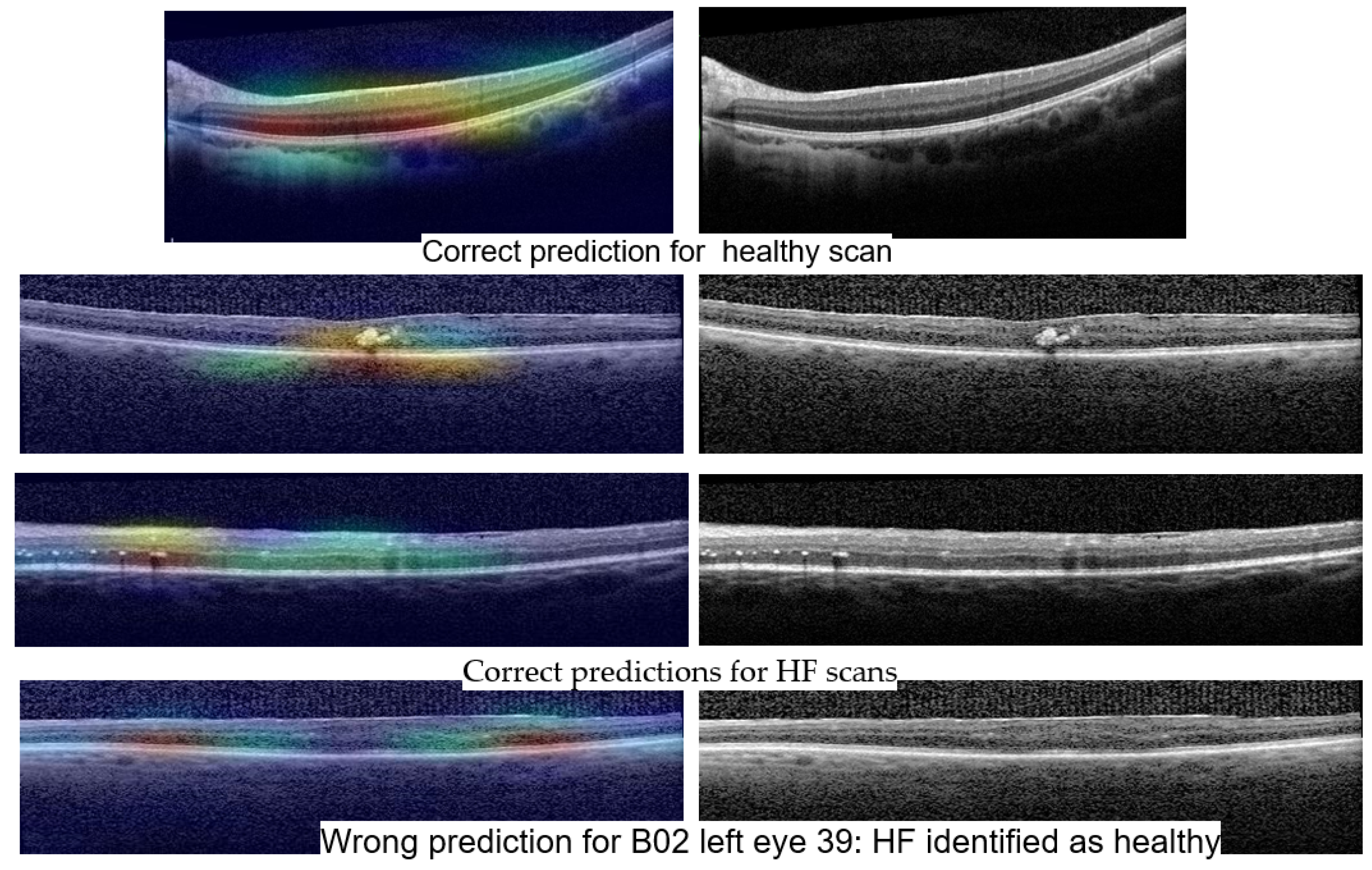 Diagnostics 14 00076 g014