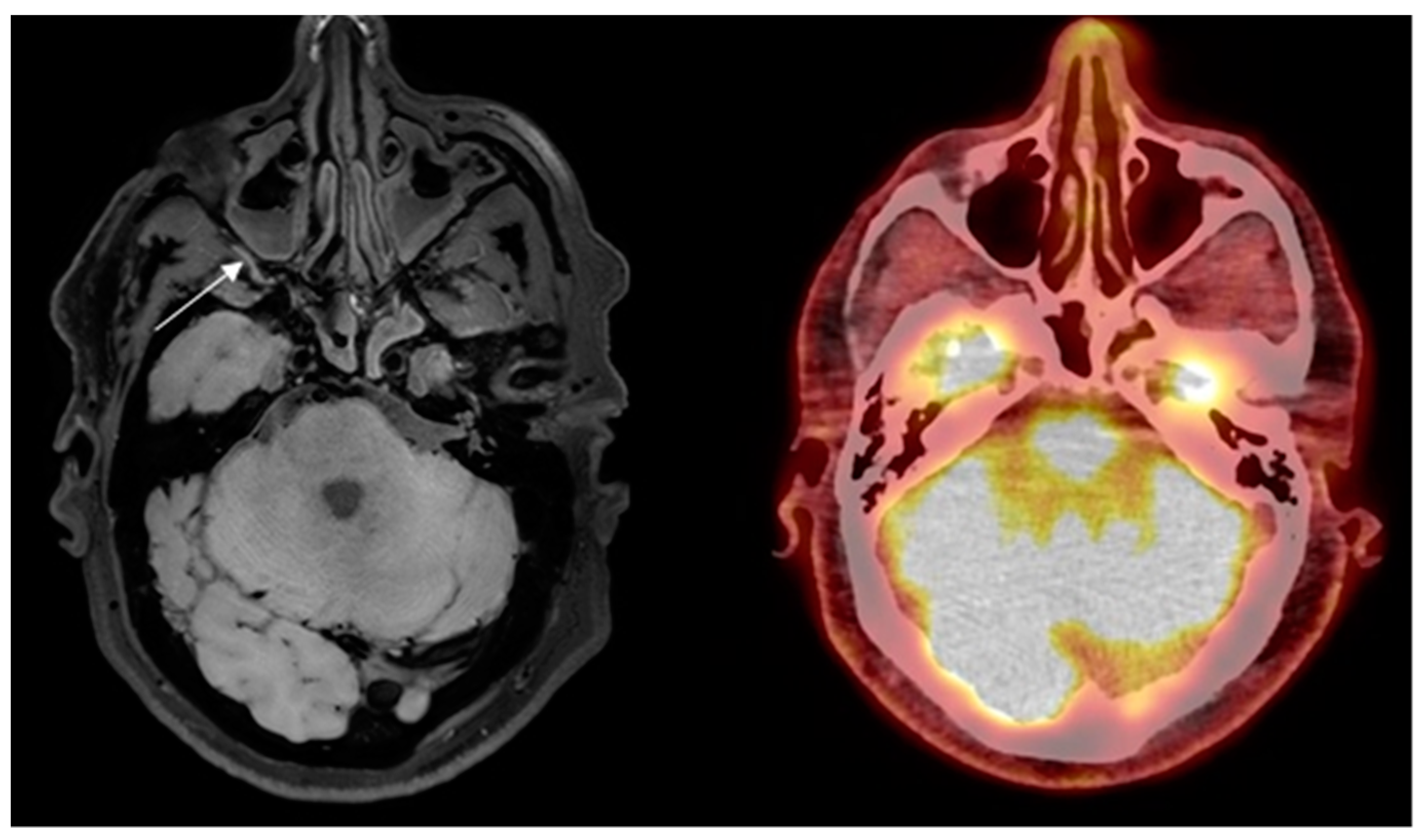 Diagnostics 14 00081 g002