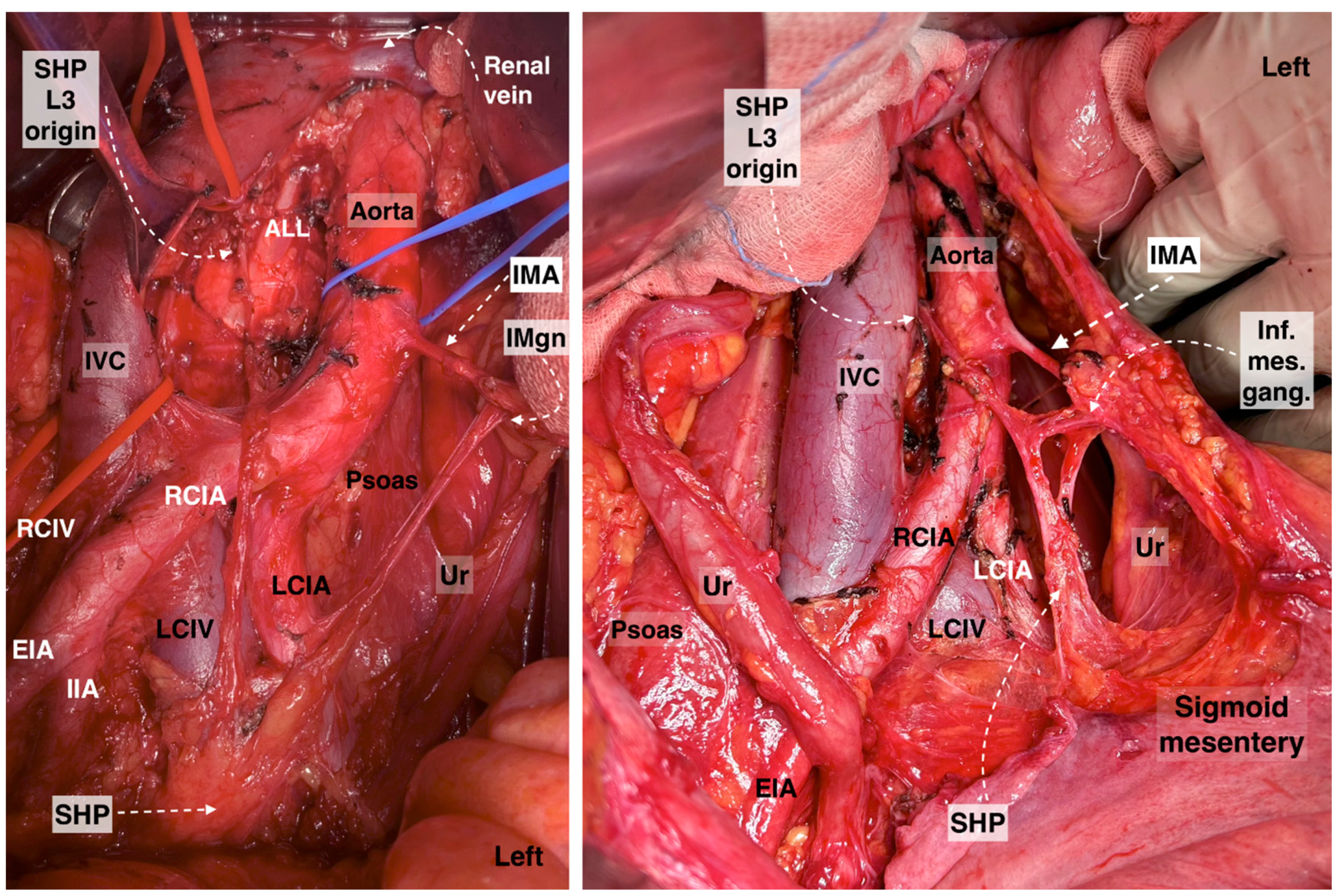 Diagnostics 14 00083 g003