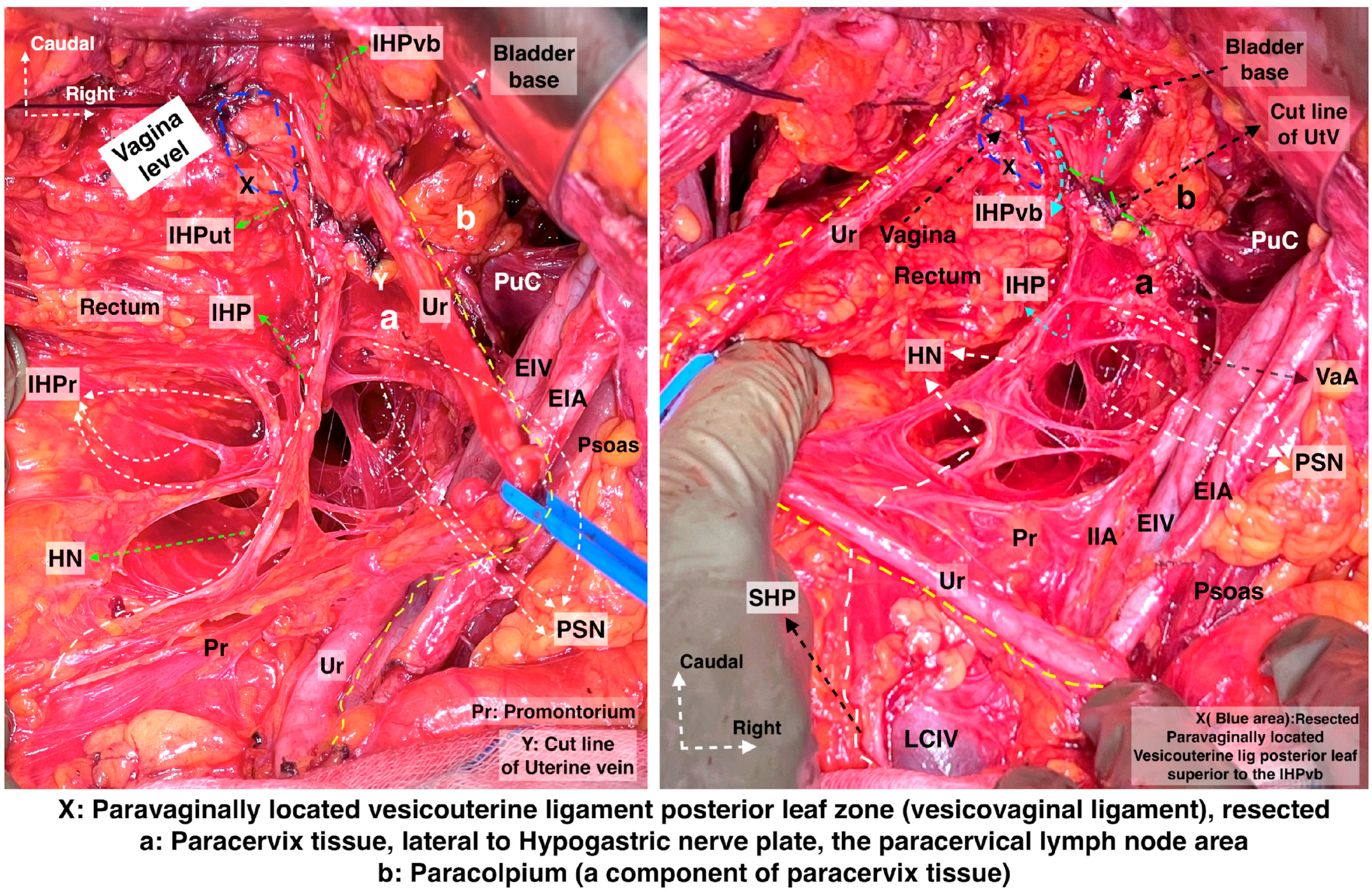 Diagnostics 14 00083 g014