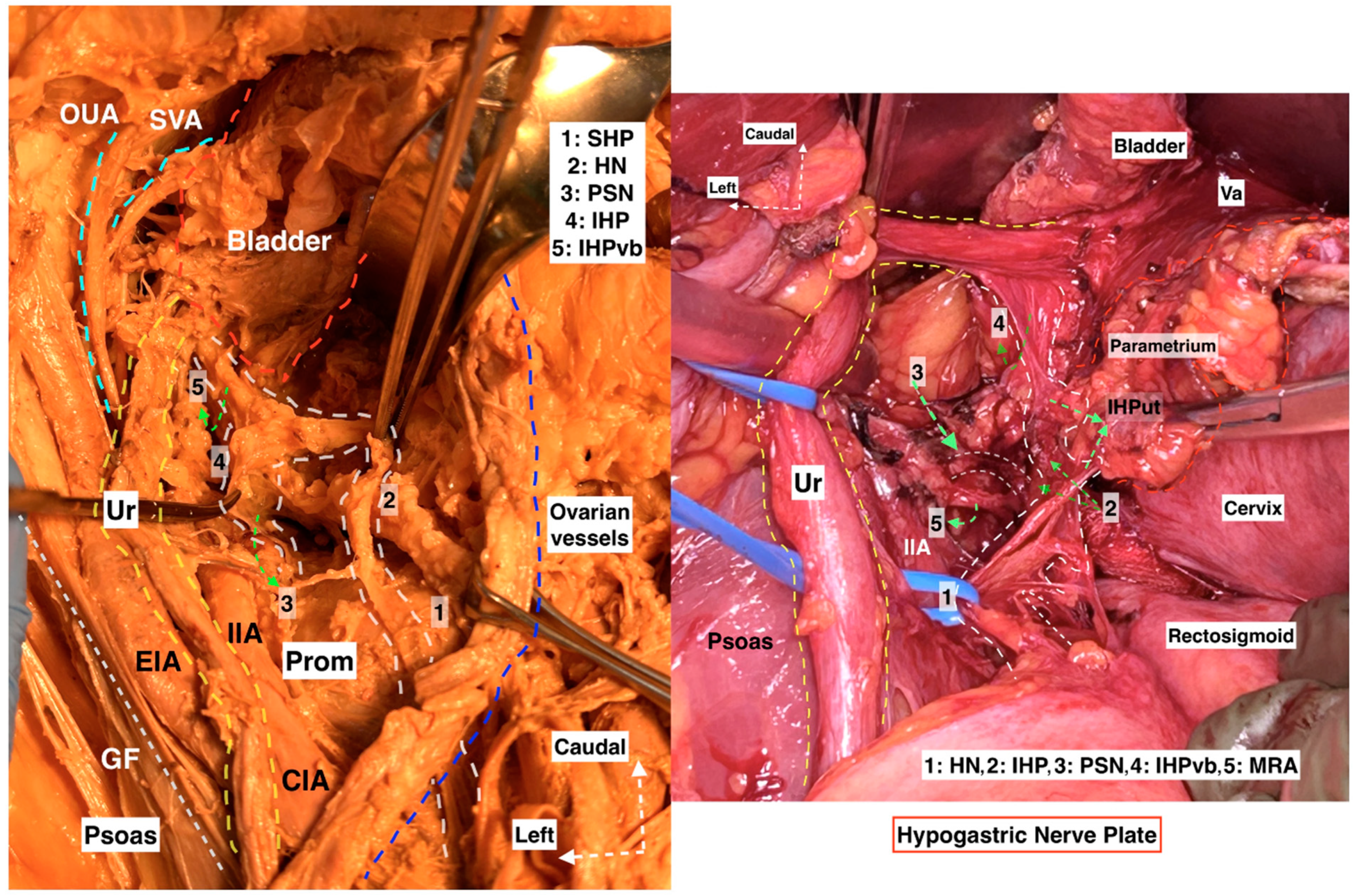 Diagnostics 14 00083 g015