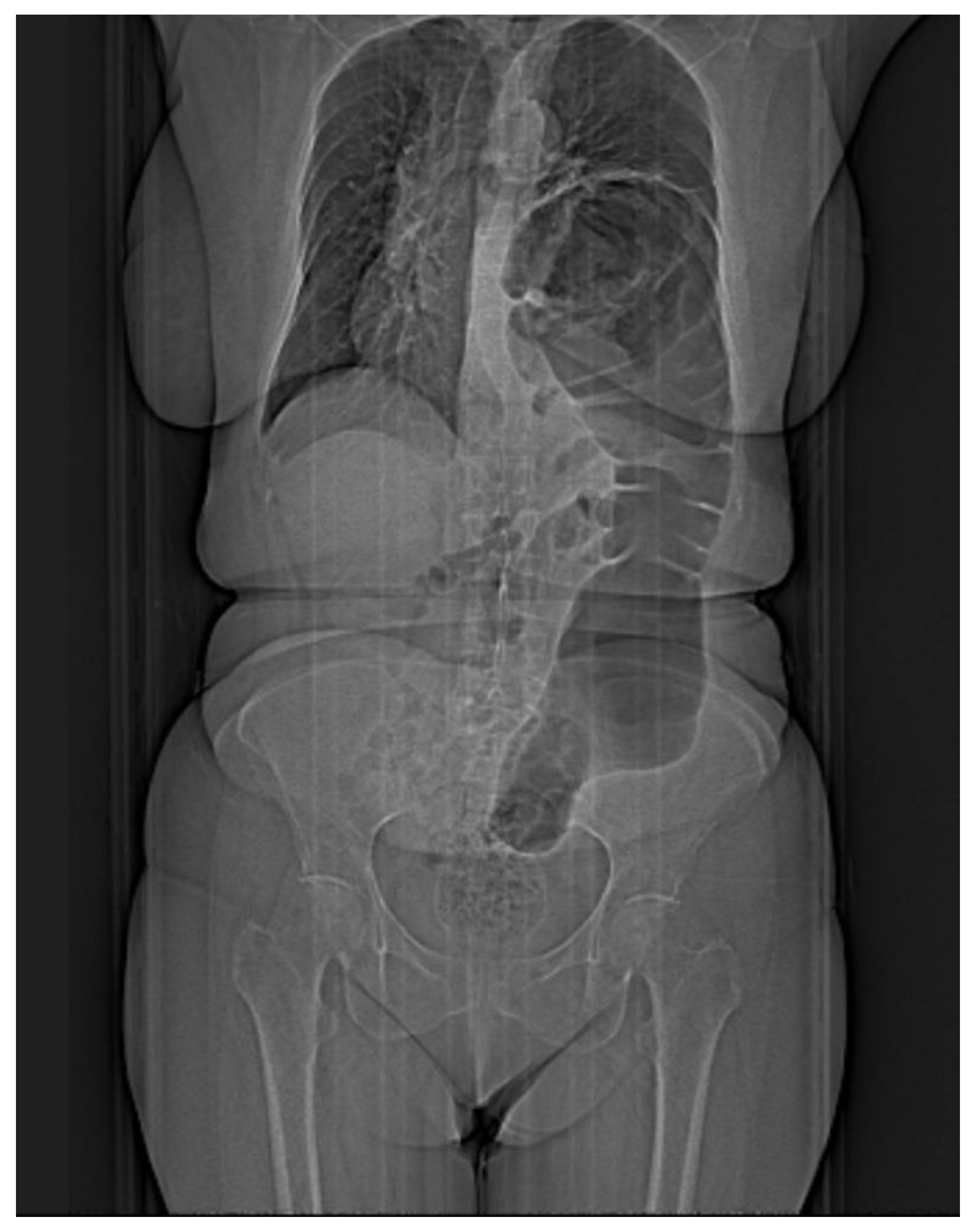 Diagnostics 14 00085 g001