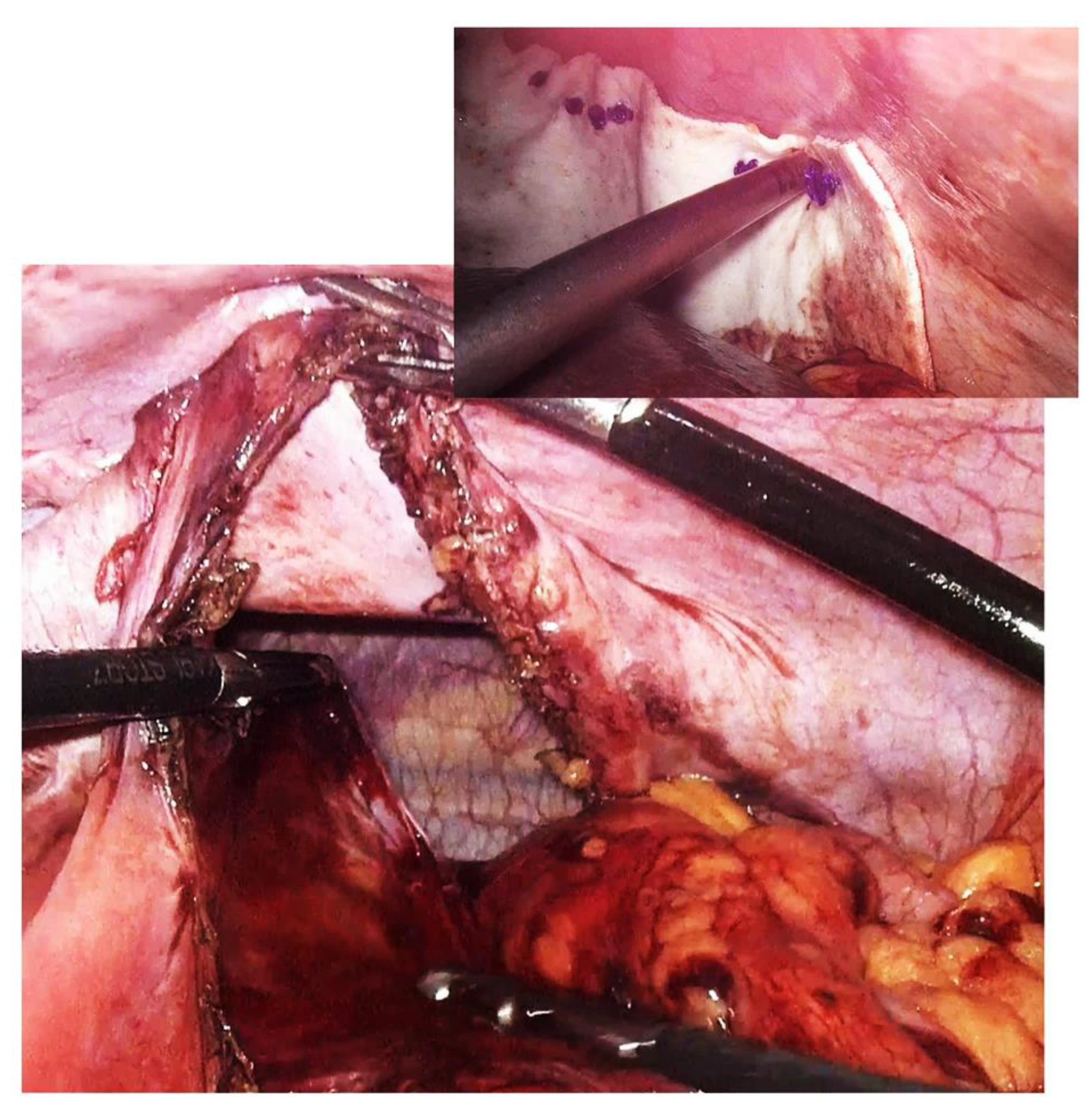 Diagnostics 14 00085 g004