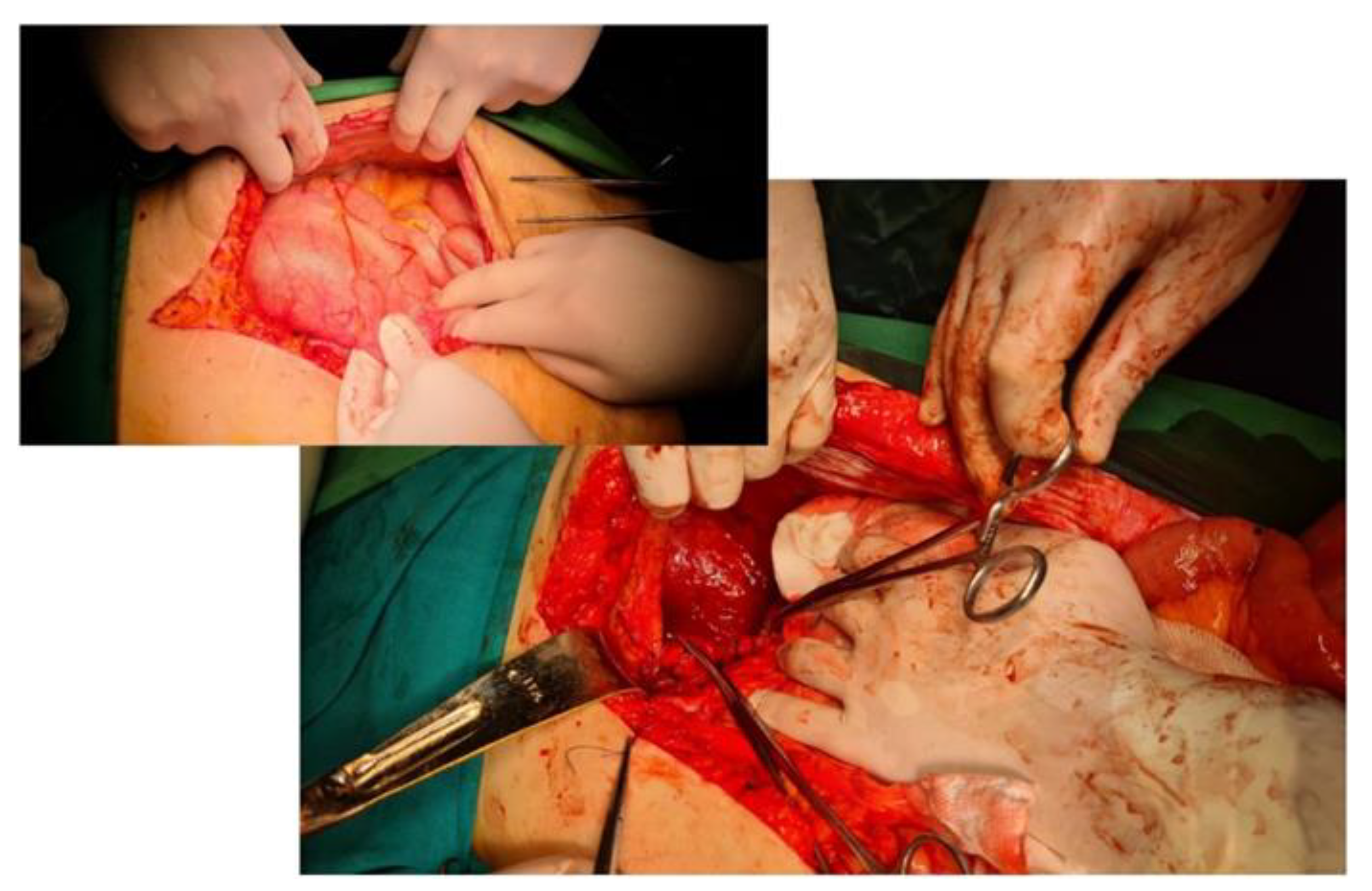 Diagnostics 14 00085 g006