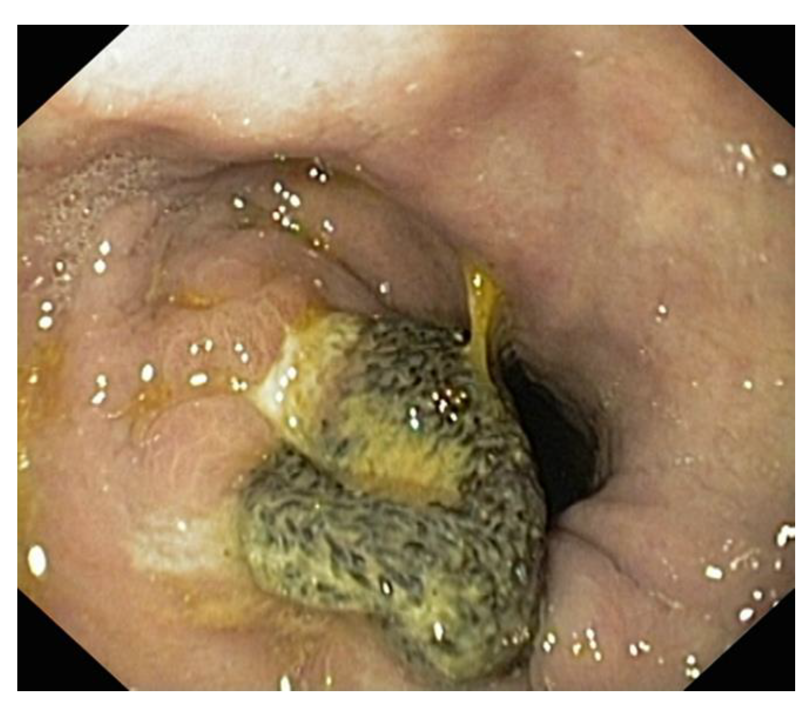 Diagnostics 14 00085 g007