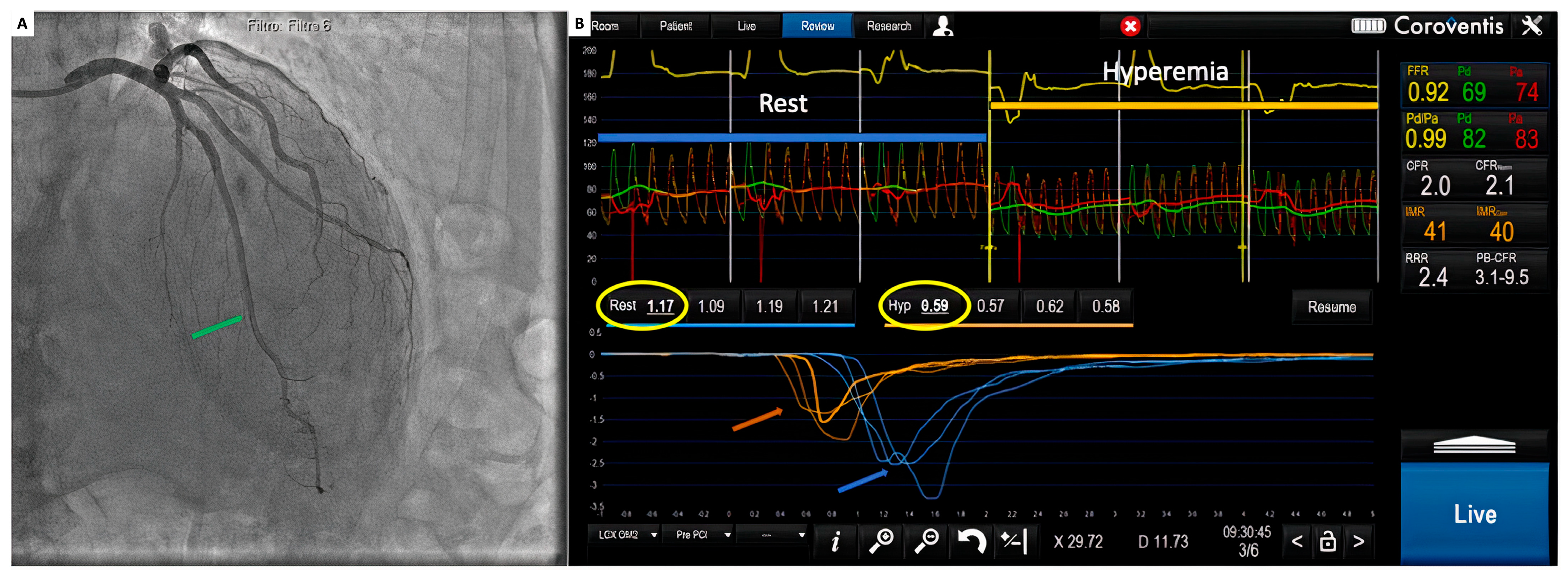 Diagnostics 14 00086 g004