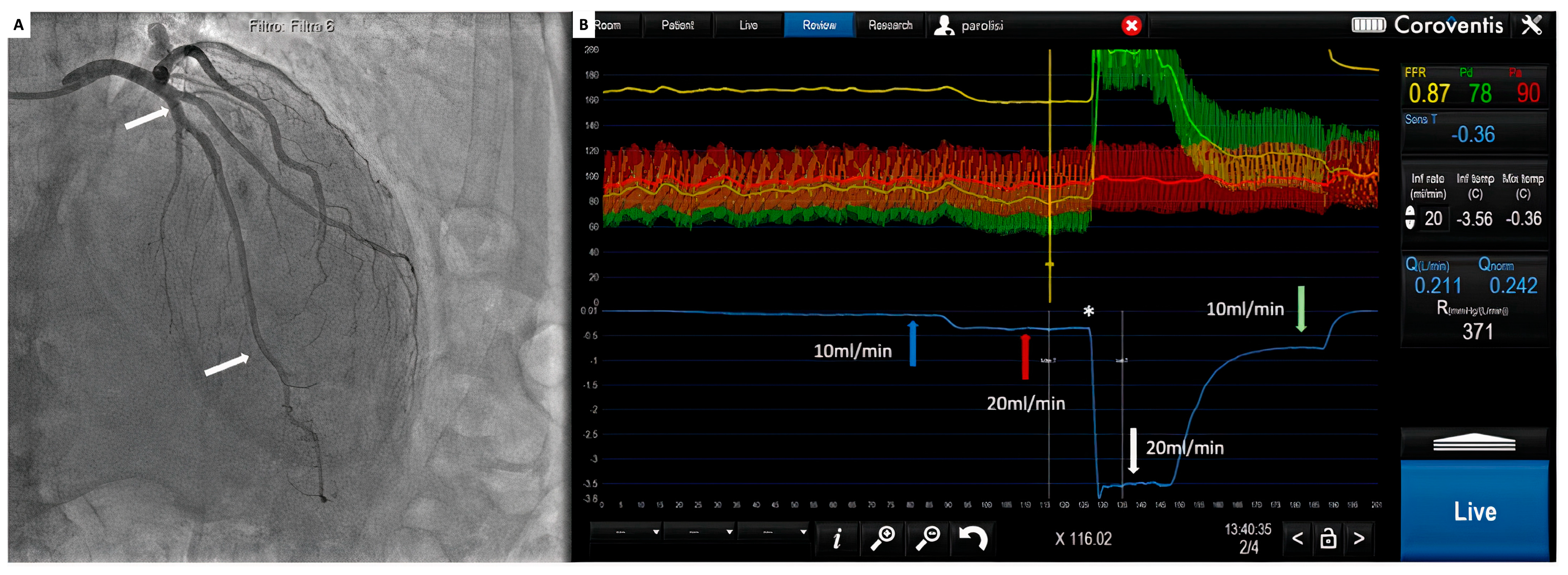 Diagnostics 14 00086 g005