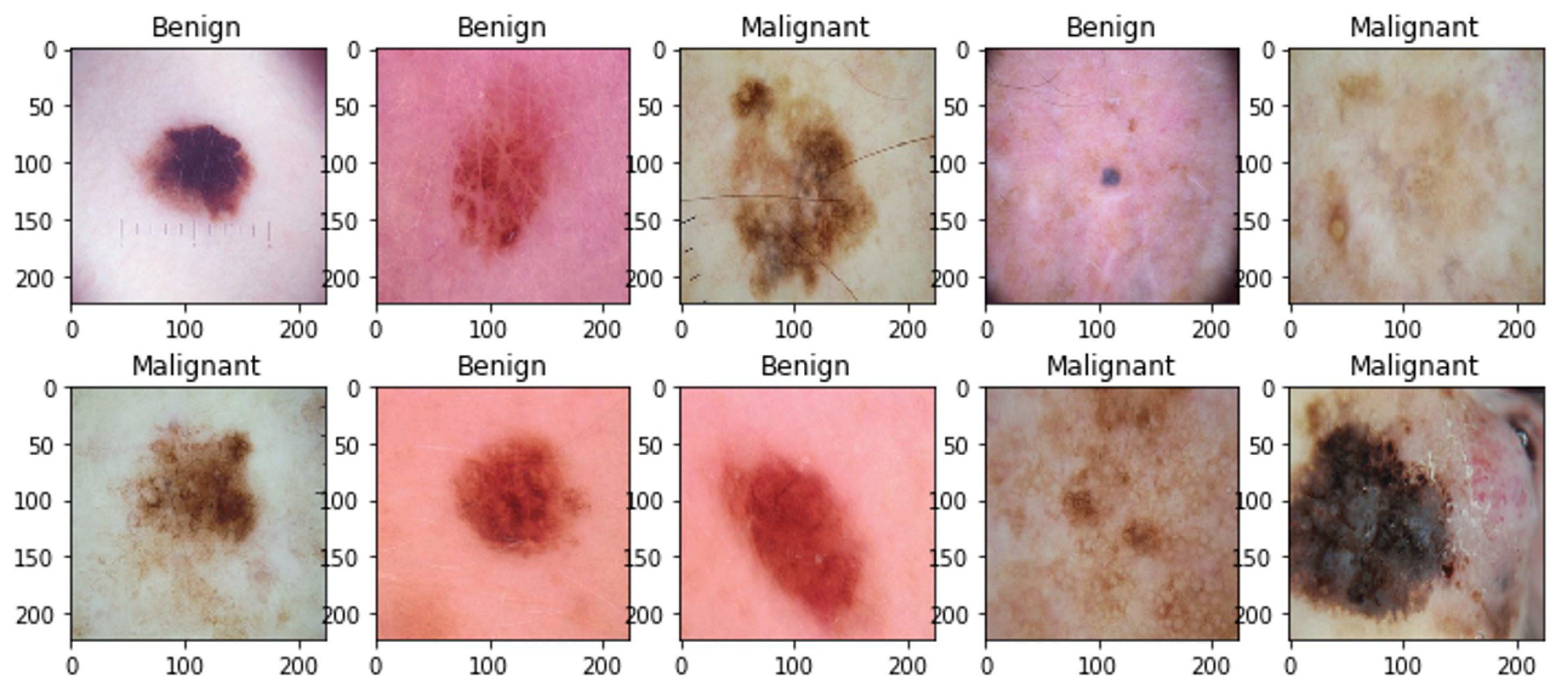 Diagnostics 14 00089 g004