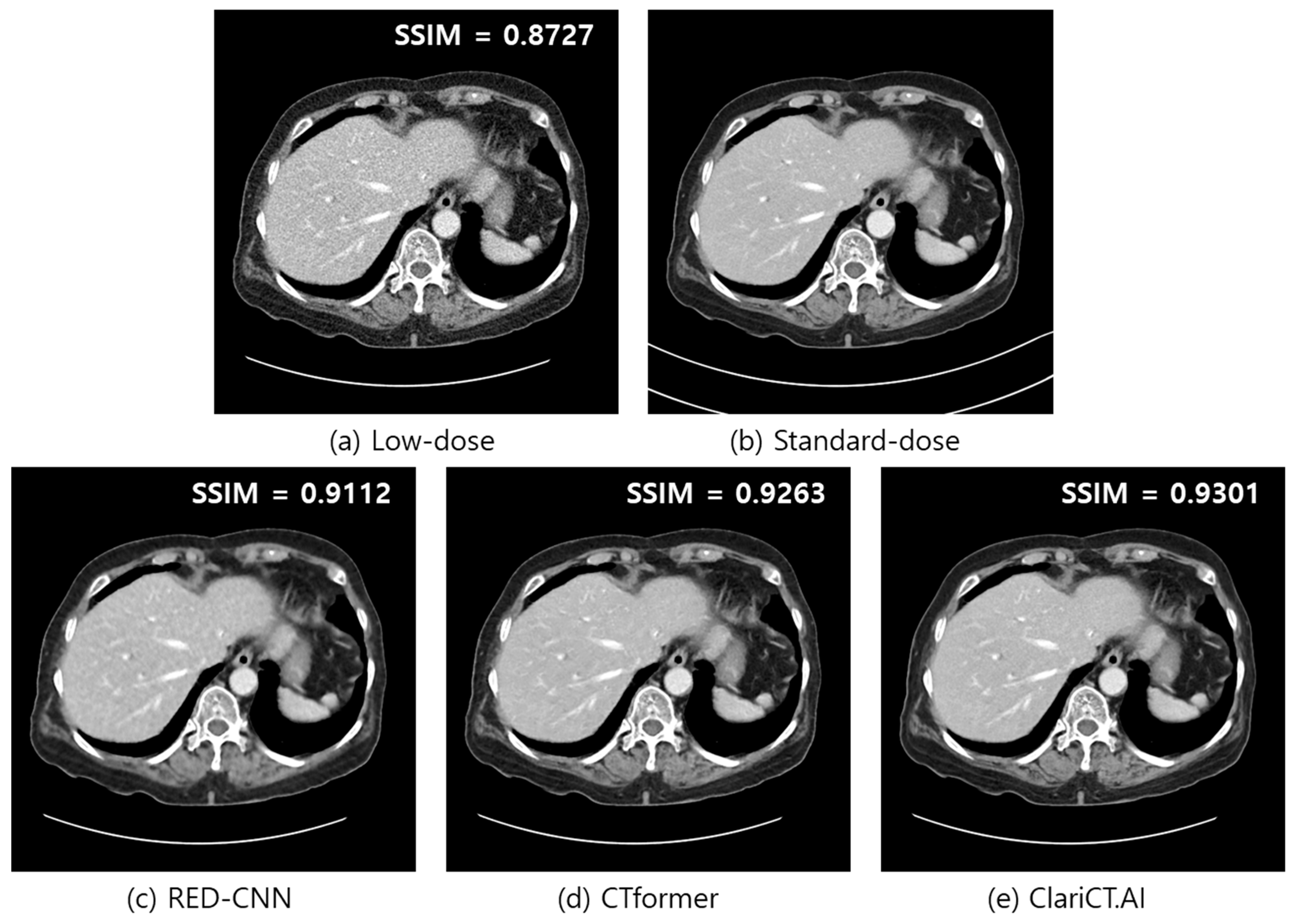 Diagnostics 14 00096 g005