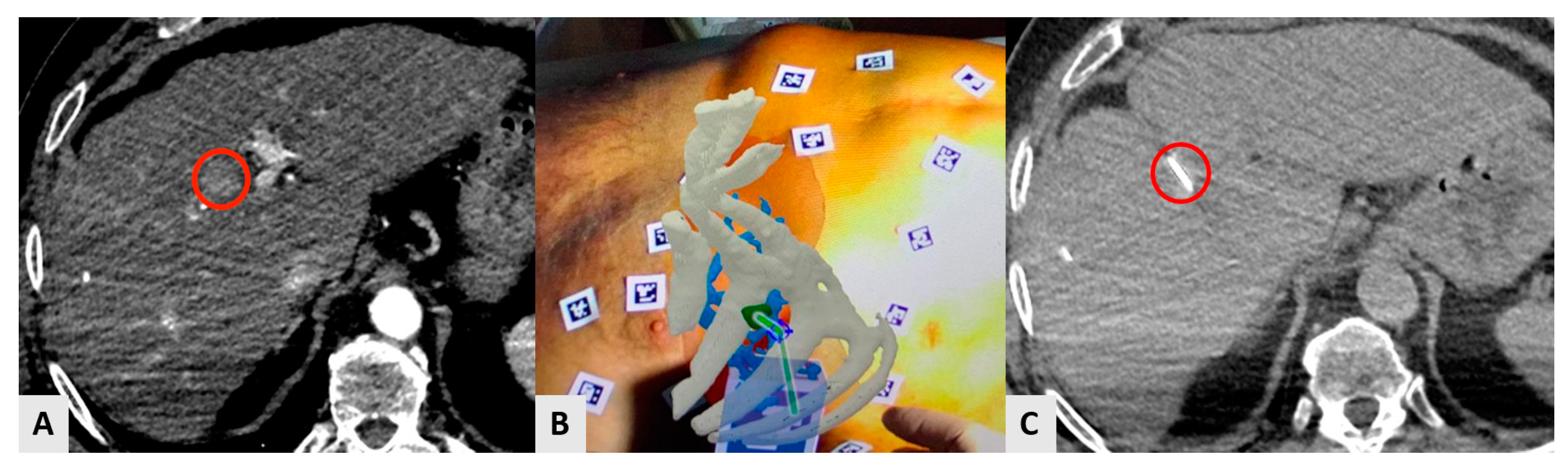 Diagnostics 14 00098 g004