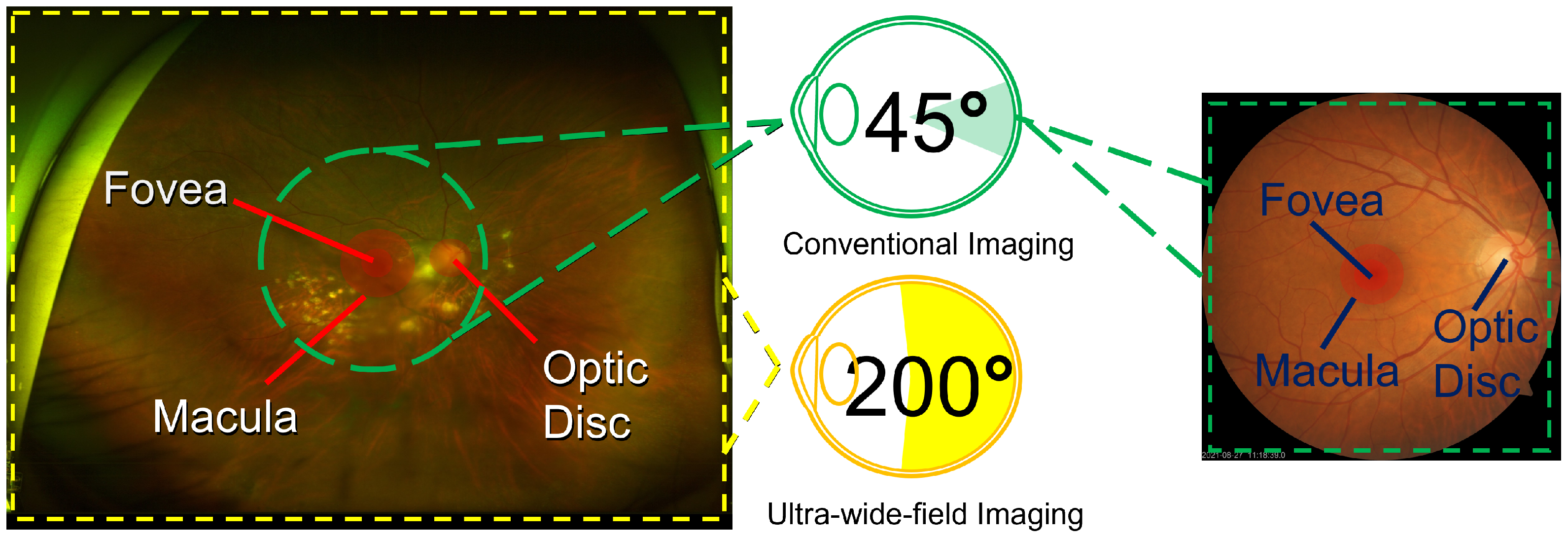Diagnostics 14 00105 g001 Diagnostics 14 00105 g001