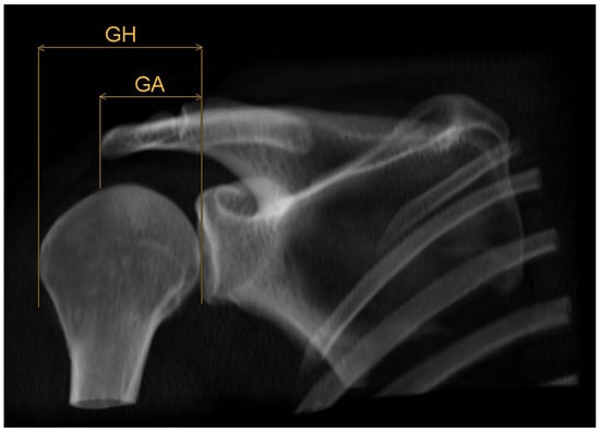 Diagnostics 14 00107 g001