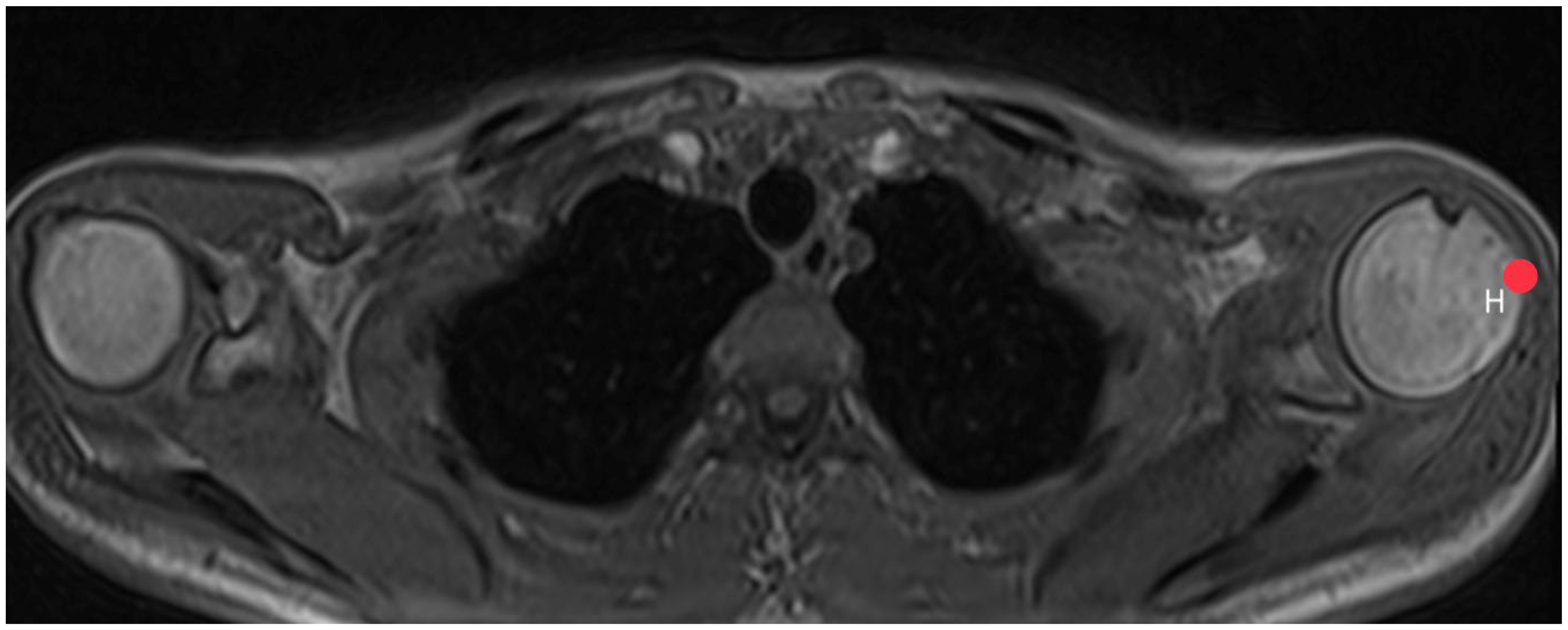 Diagnostics 14 00107 g004 Diagnostics 14 00107 g004