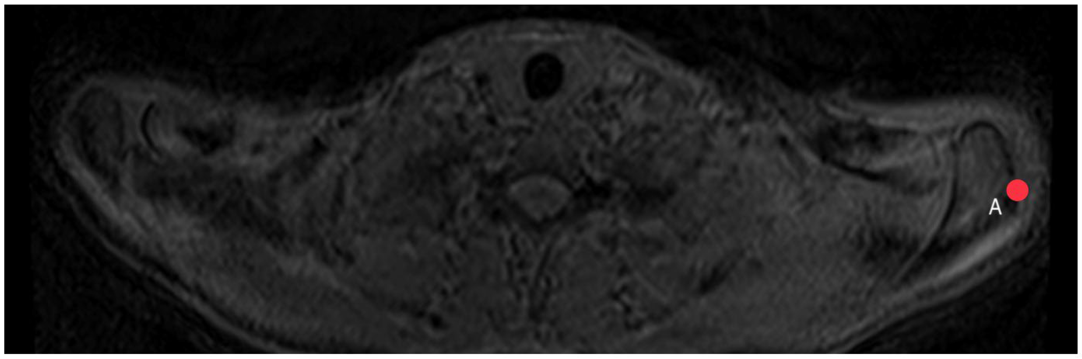Diagnostics 14 00107 g005 Diagnostics 14 00107 g005