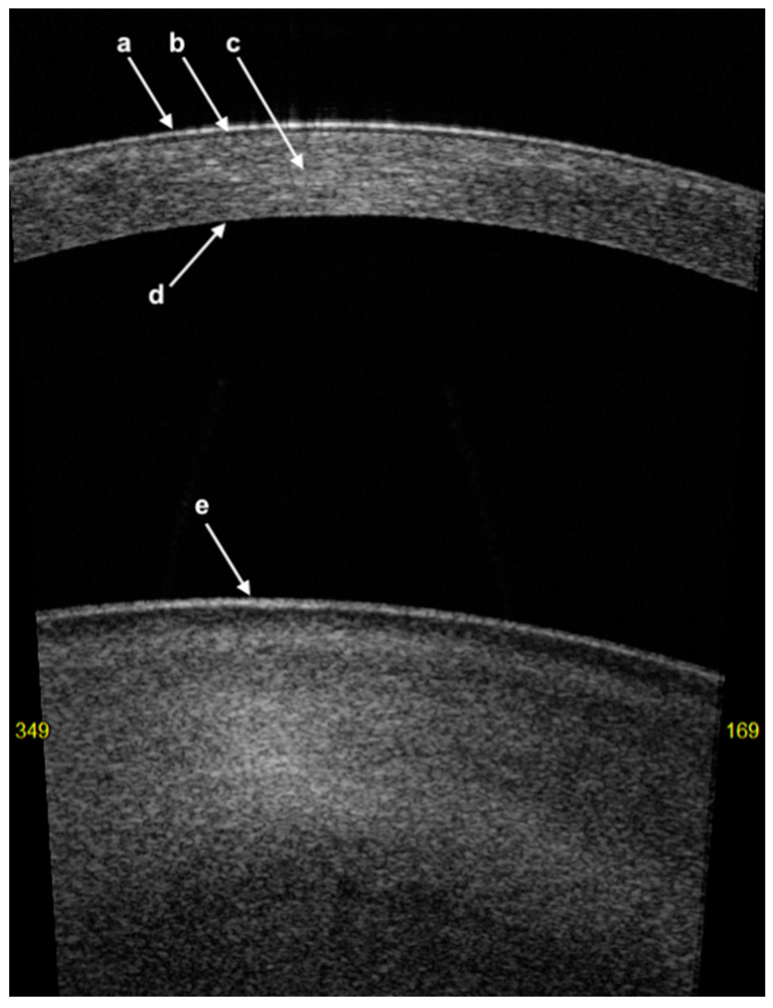 Diagnostics 14 00122 g001