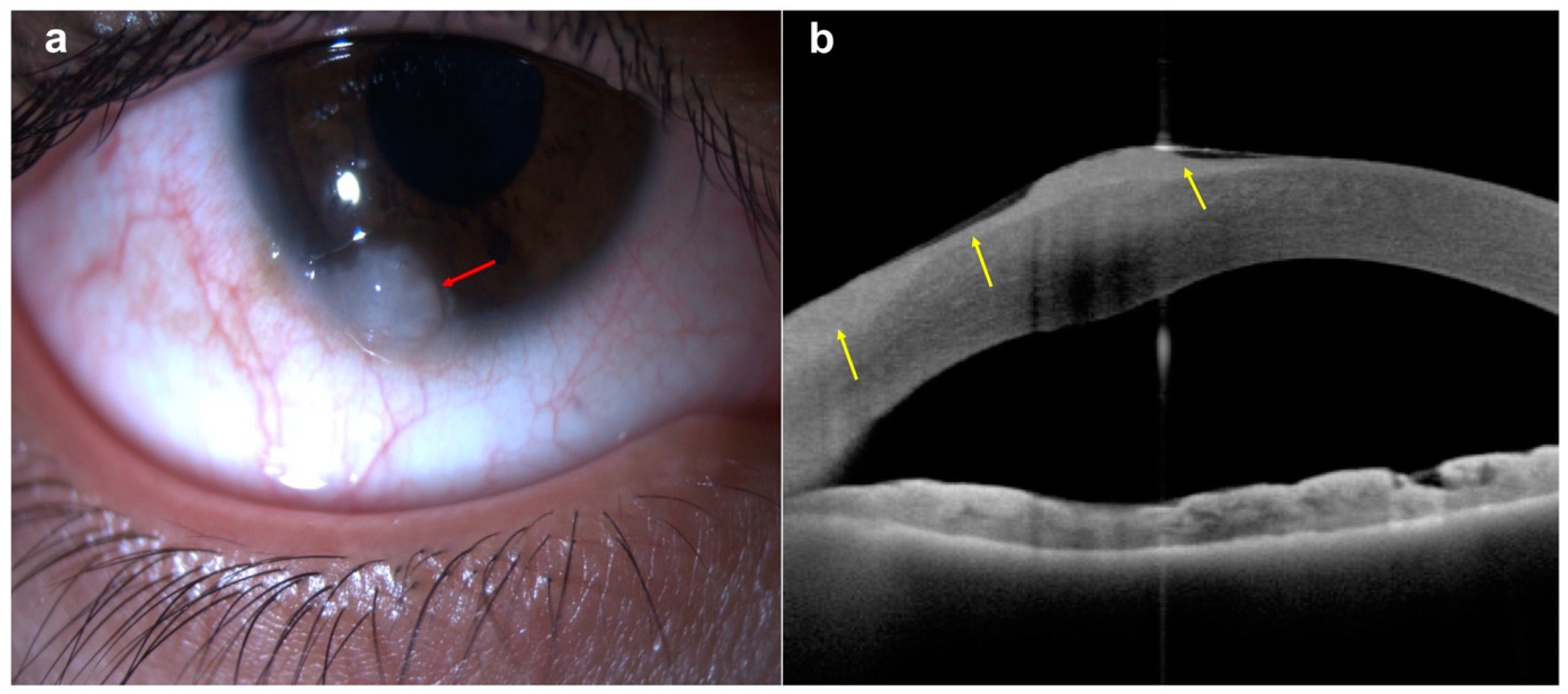 Diagnostics 14 00122 g004
