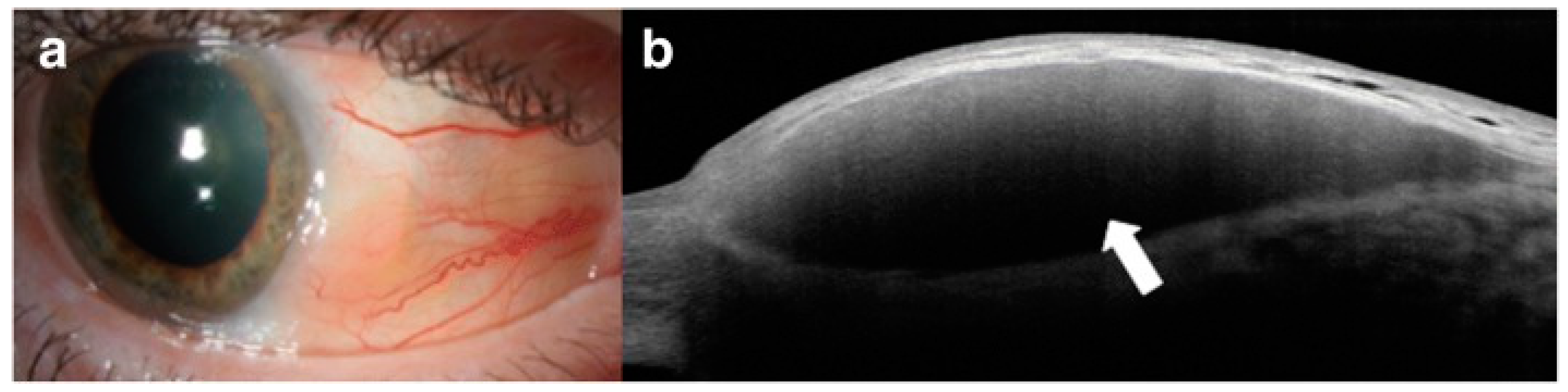 Diagnostics 14 00122 g005