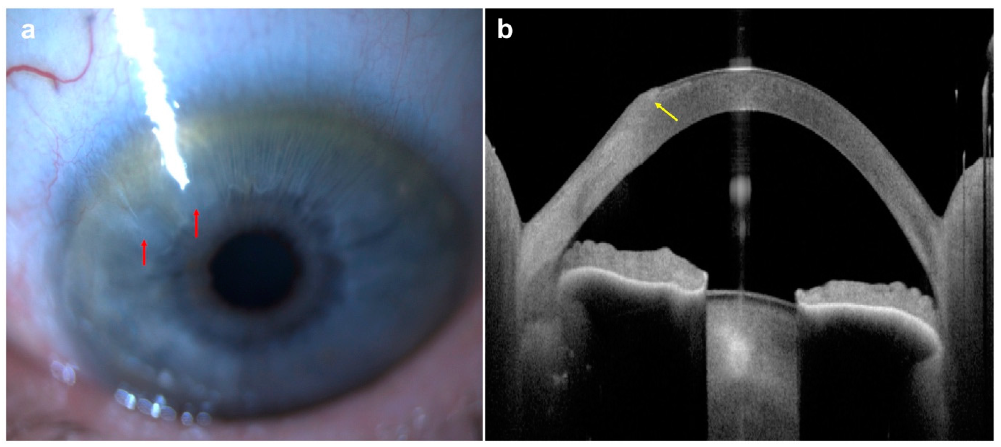 Diagnostics 14 00122 g006