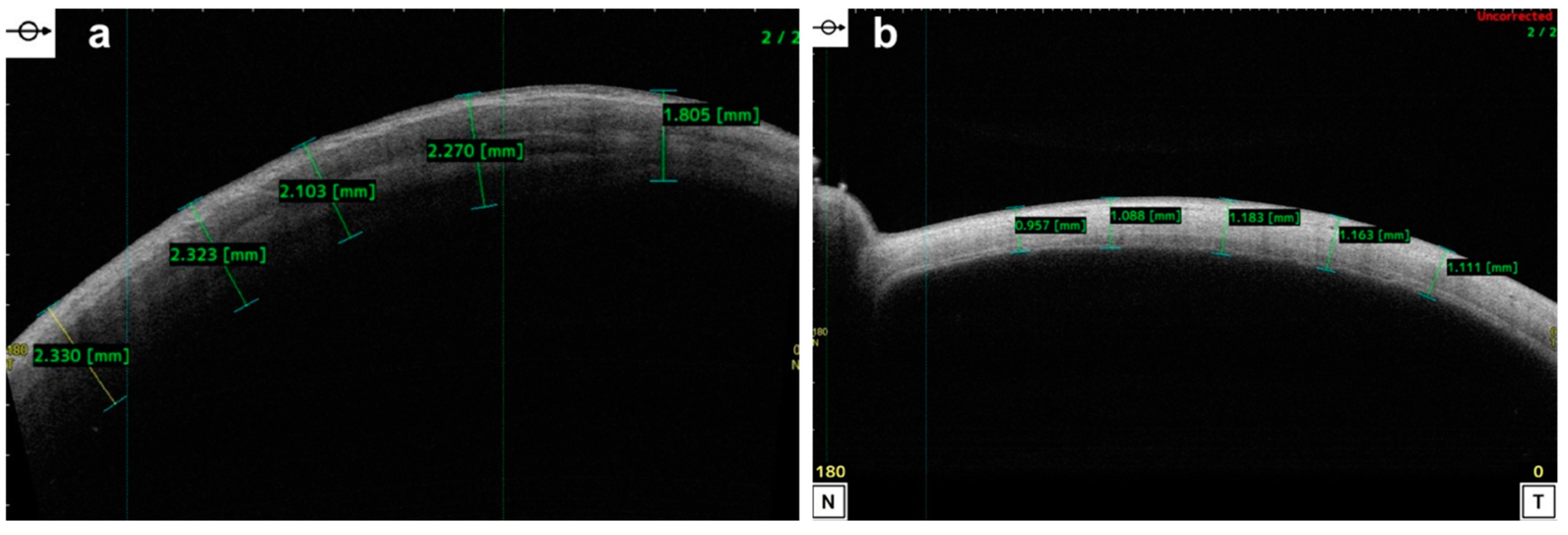 Diagnostics 14 00122 g007