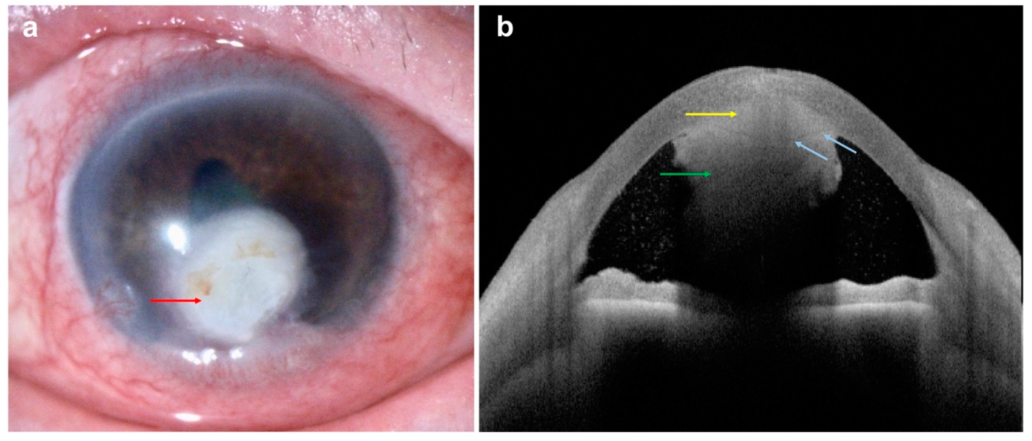 Diagnostics 14 00122 g011