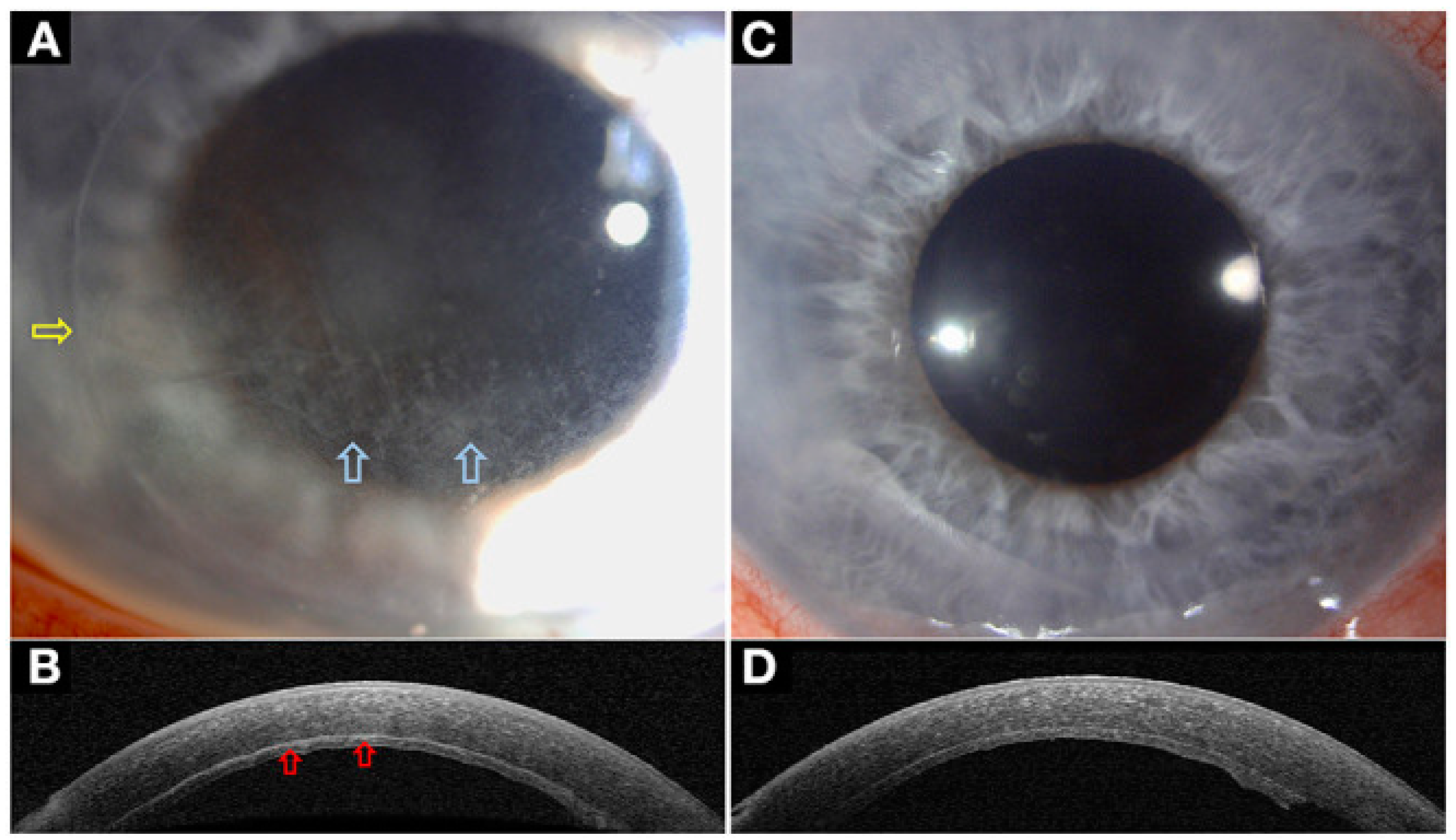 Diagnostics 14 00122 g014