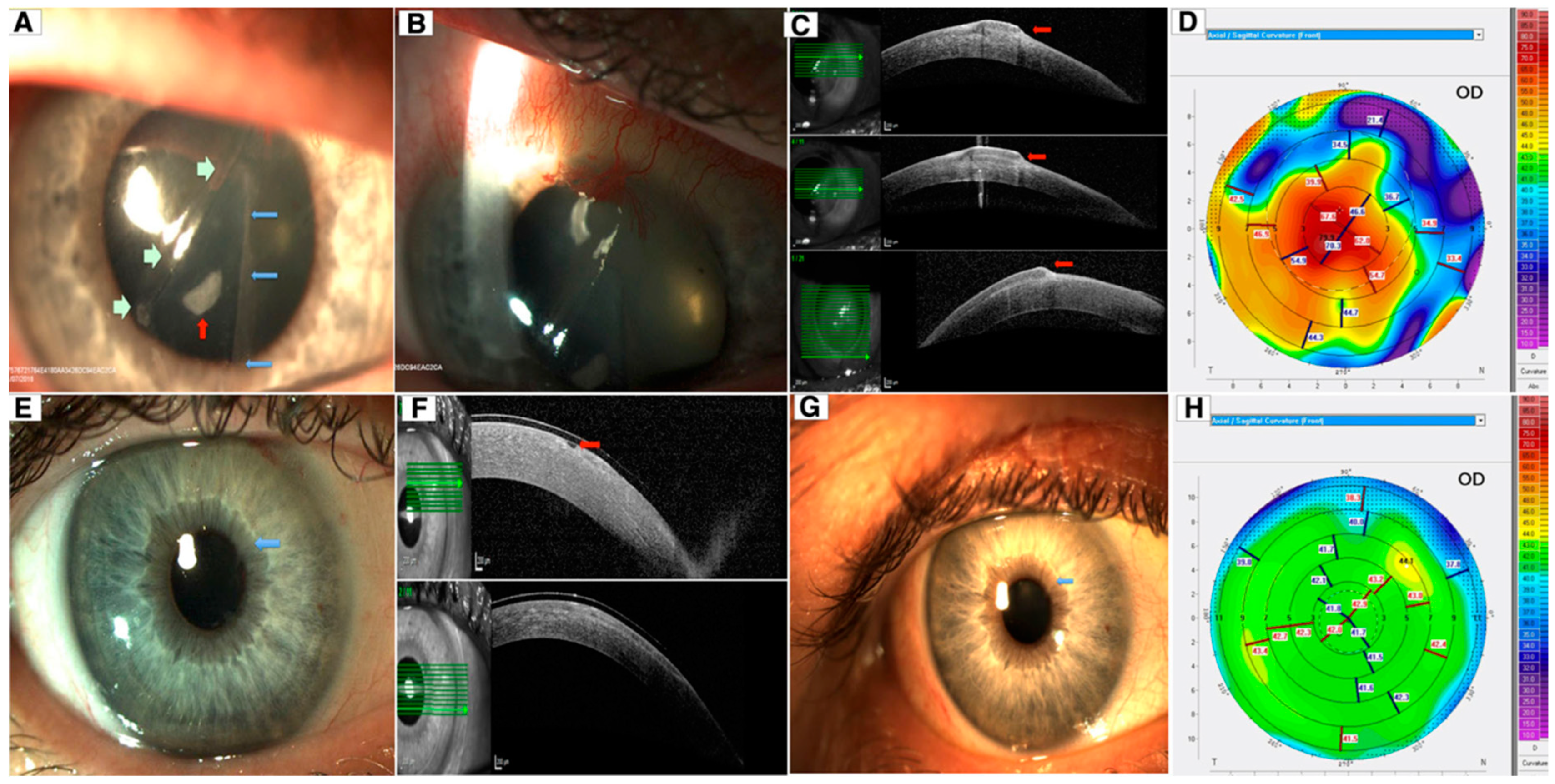 Diagnostics 14 00122 g015