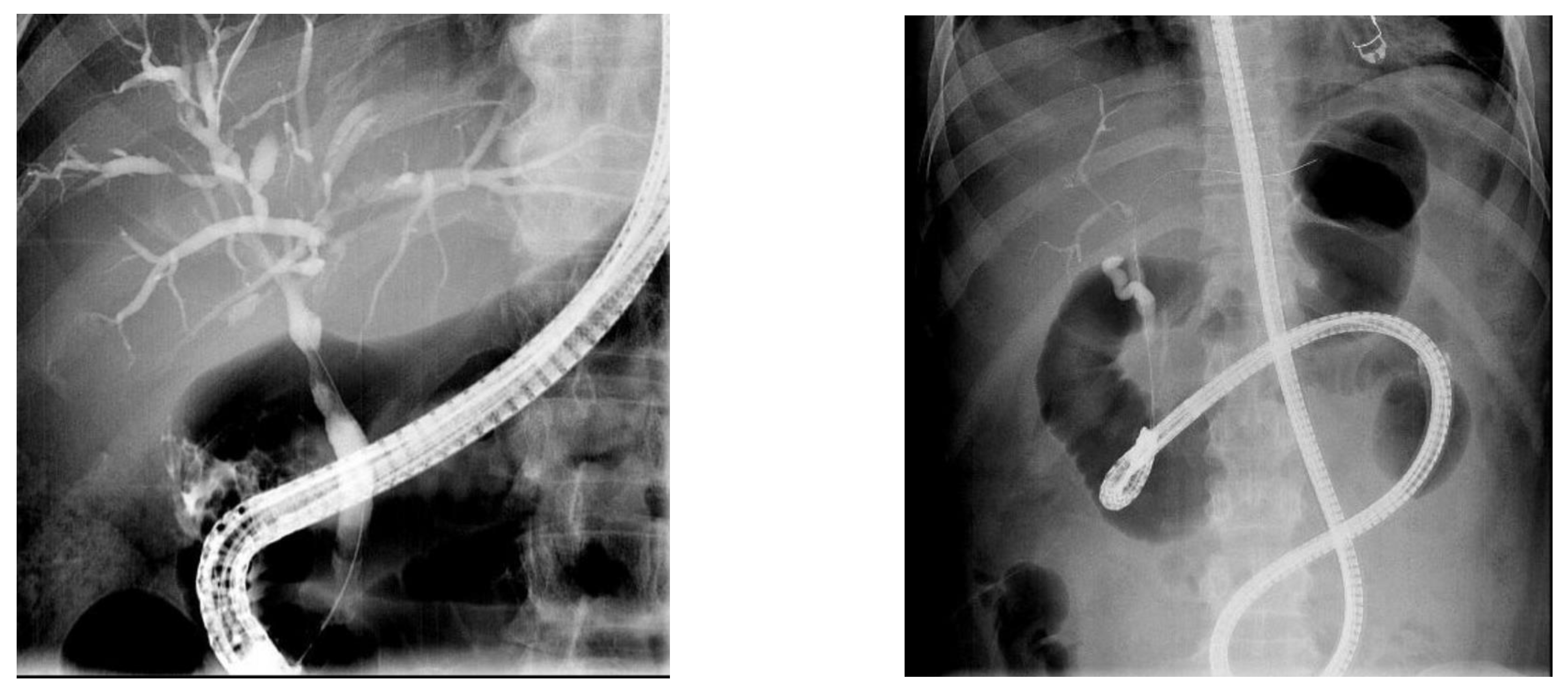 Diagnostics 14 00142 g002
