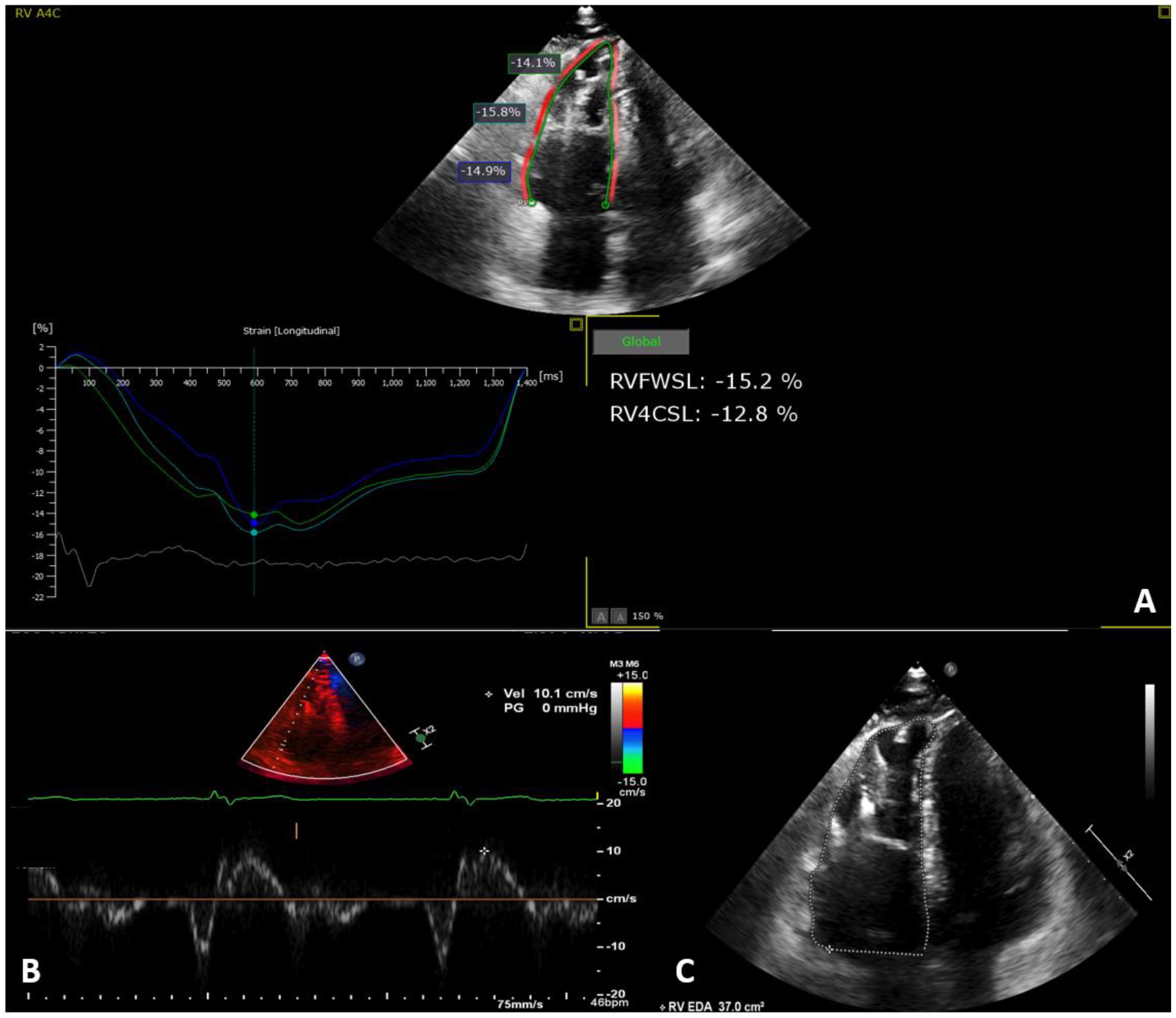 Diagnostics 14 00150 g001