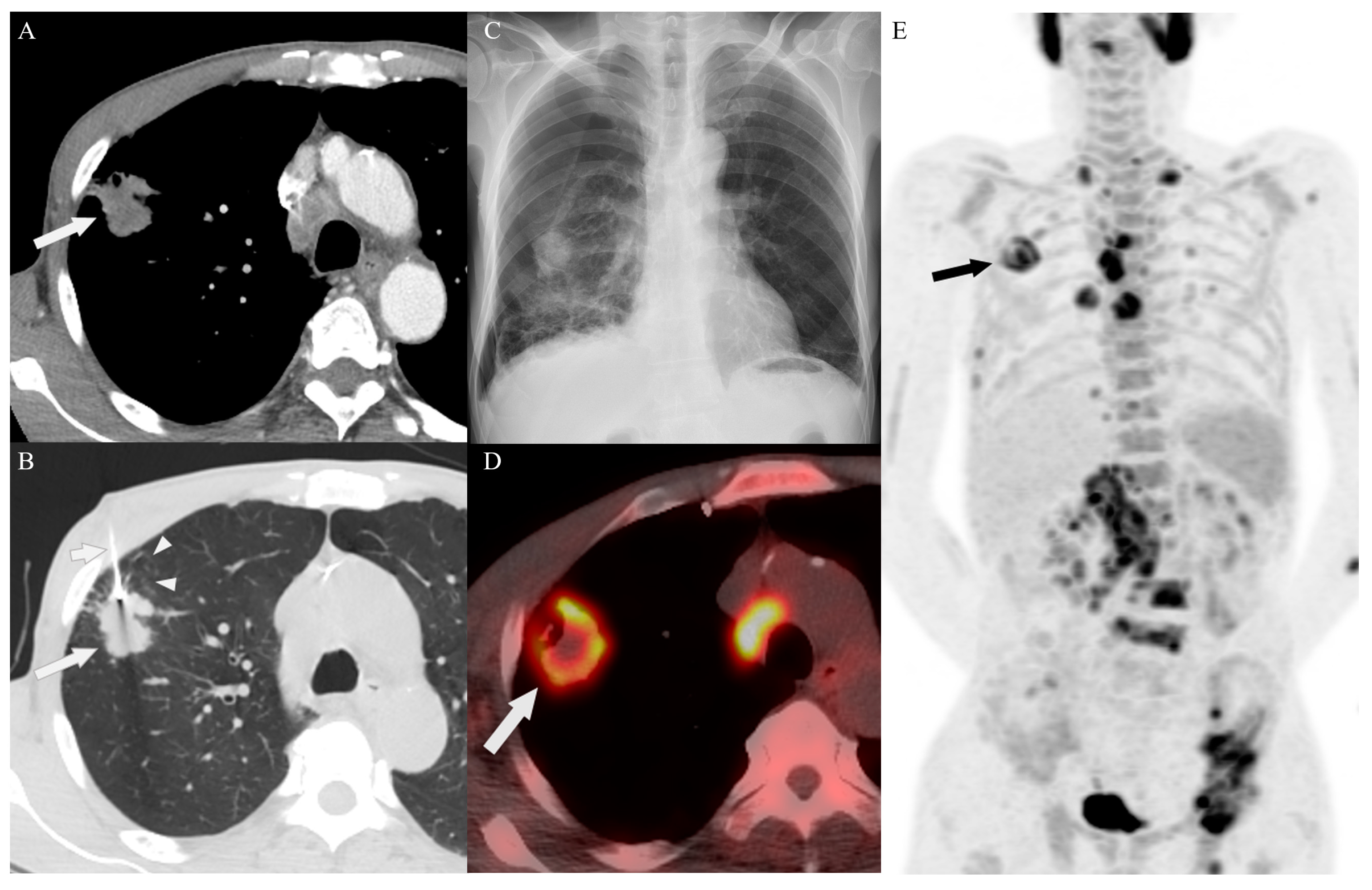 Diagnostics 14 00153 g002