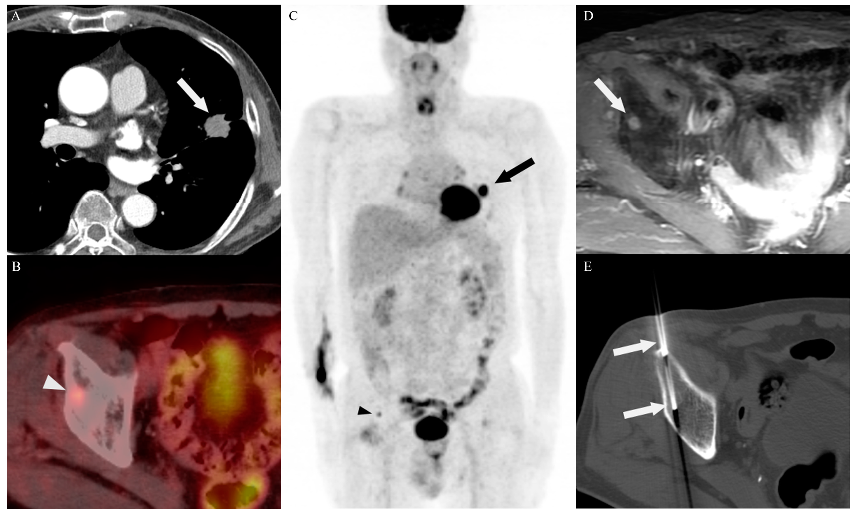 Diagnostics 14 00153 g003