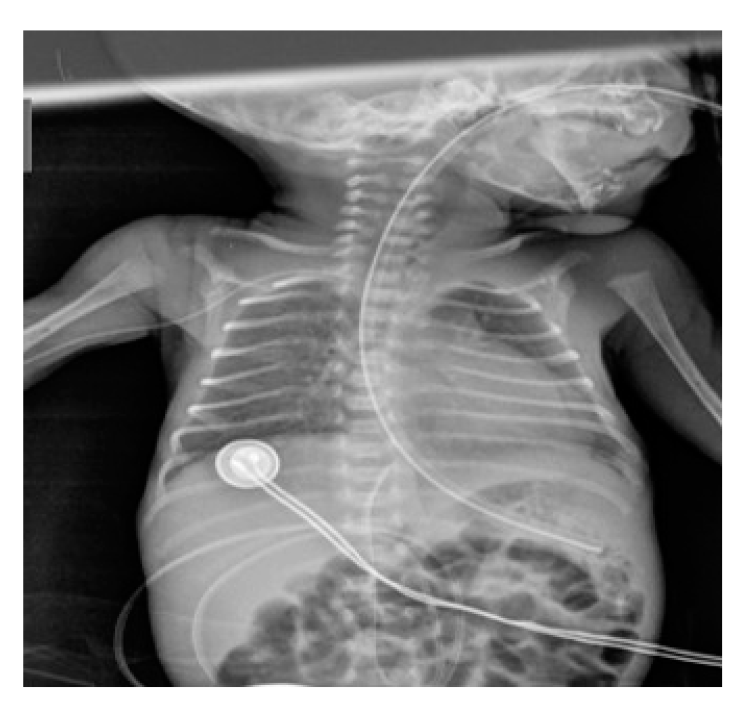 Diagnostics 14 00157 g002