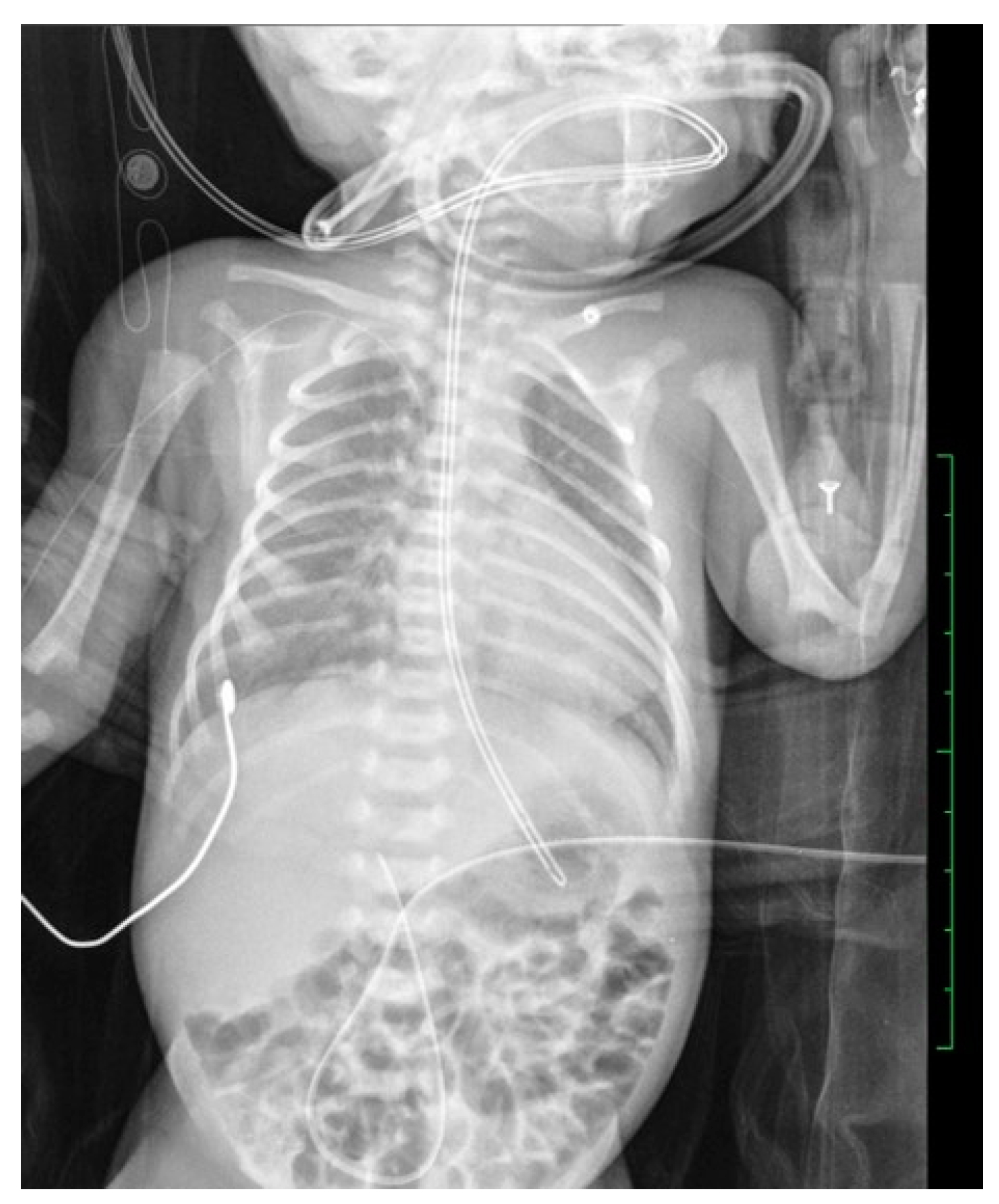 Diagnostics 14 00157 g004