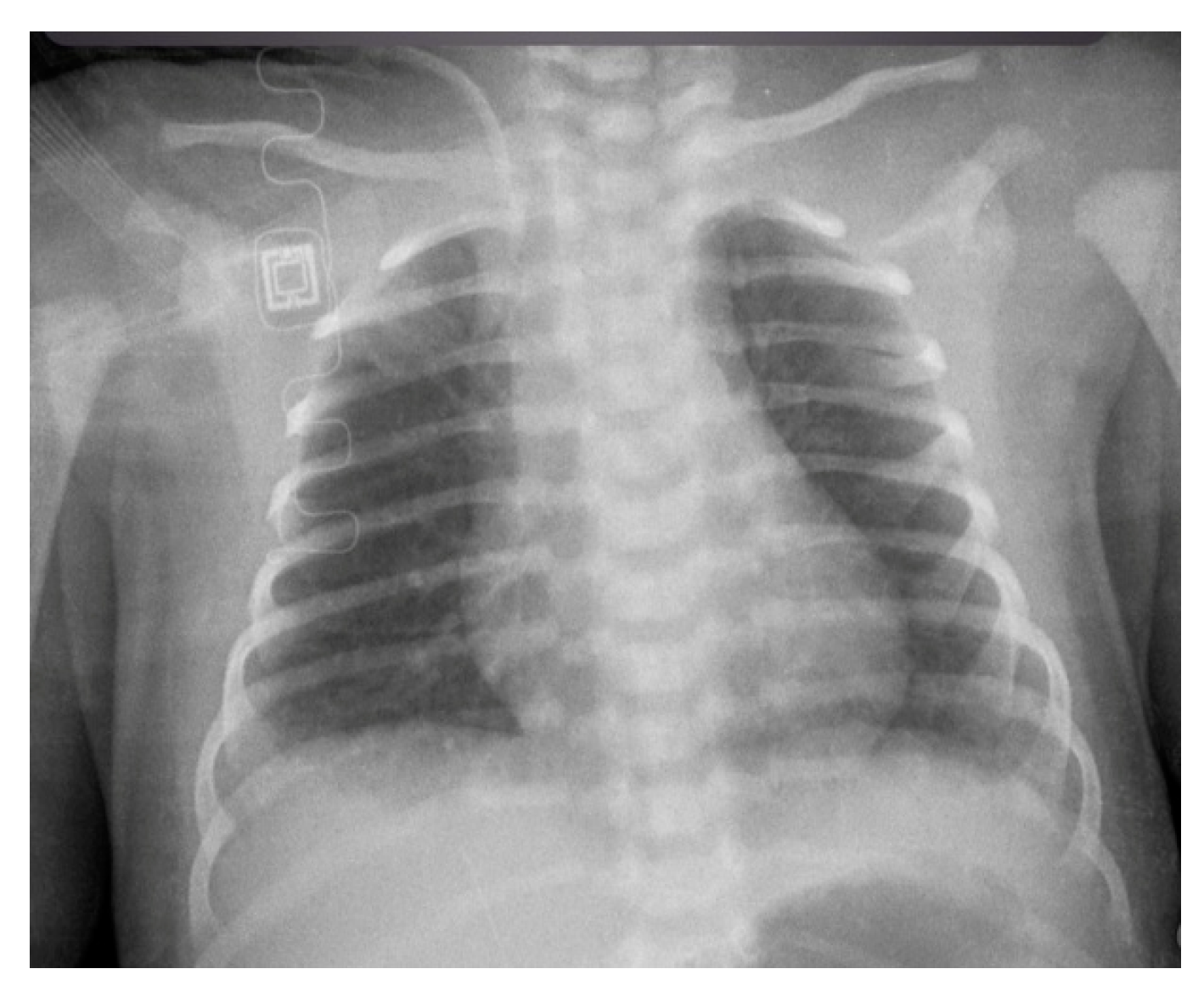 Diagnostics 14 00157 g007