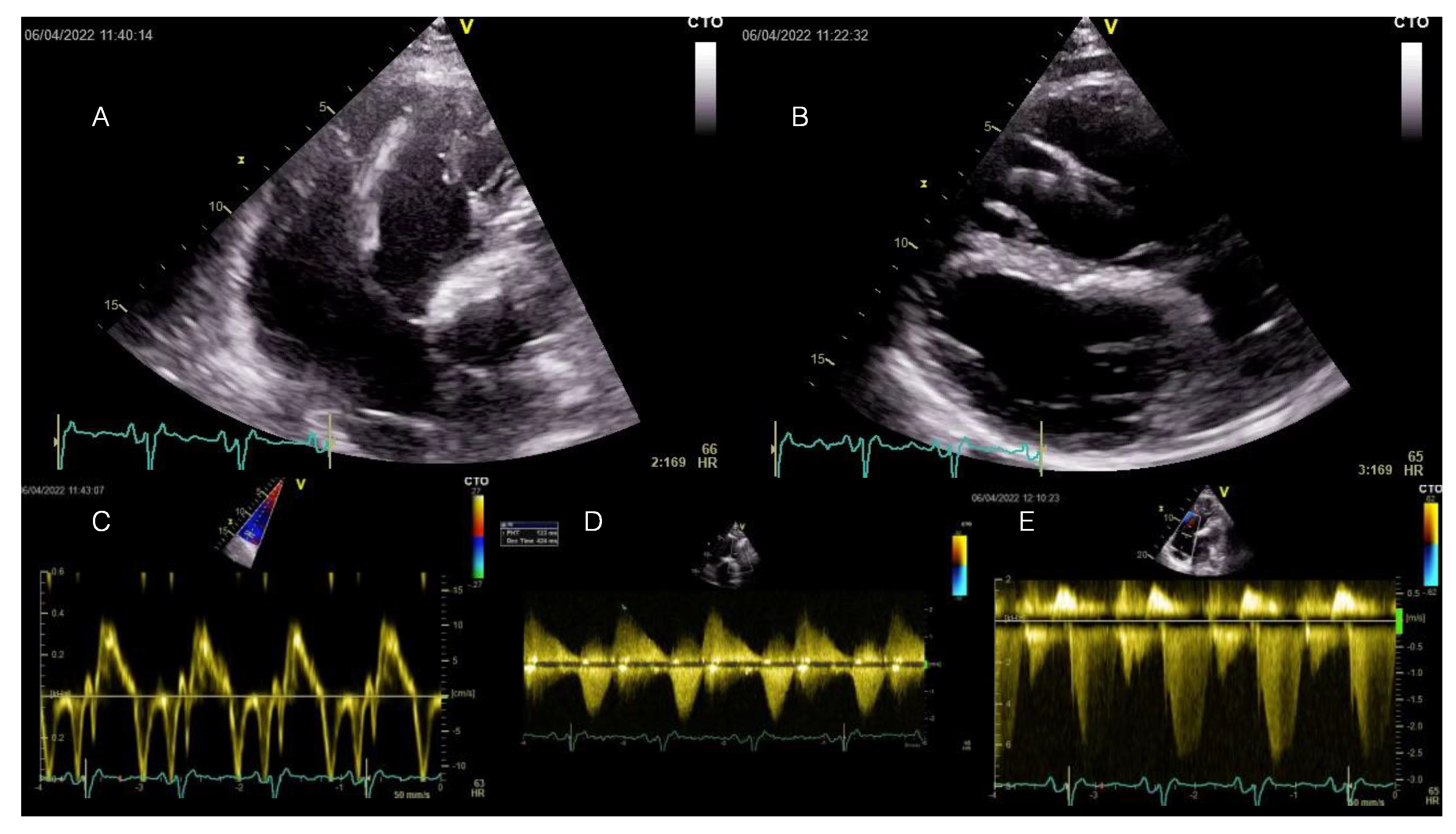 Diagnostics 14 00158 g002