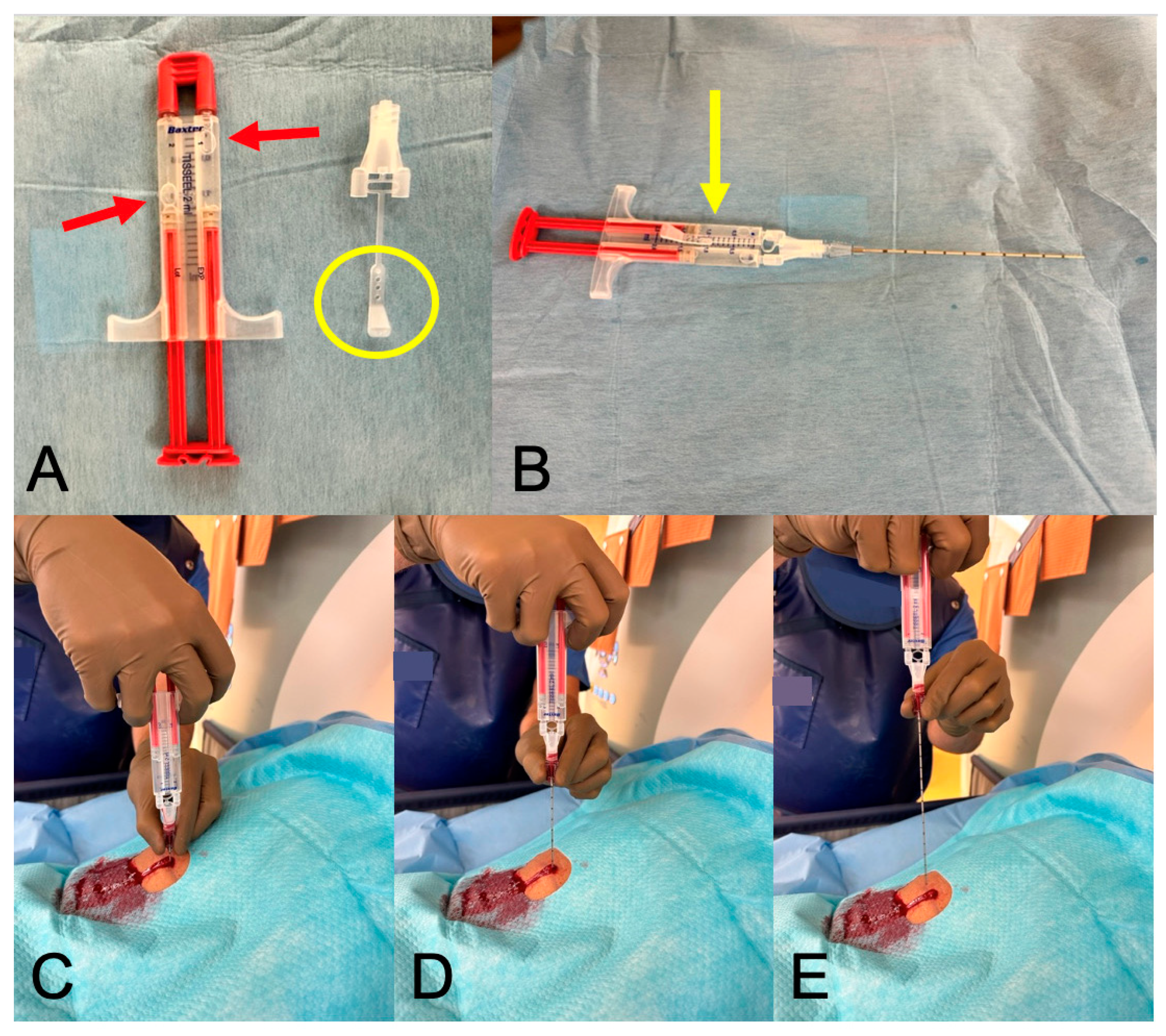 Diagnostics 14 00162 g001