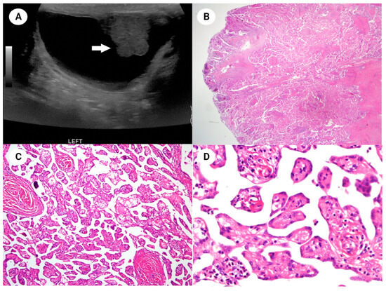 Diagnostics 14 00169 g001