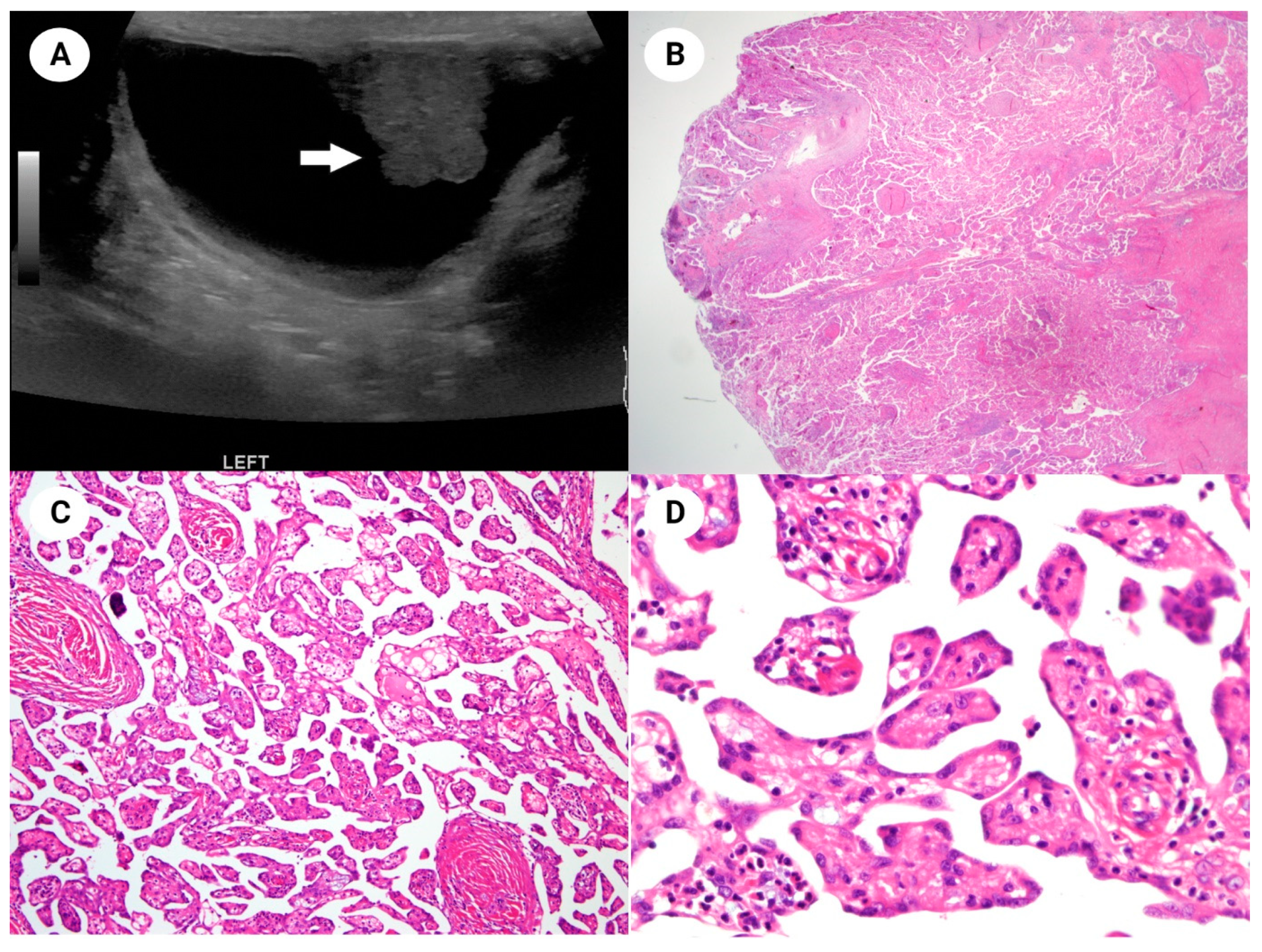 Diagnostics 14 00169 g001
