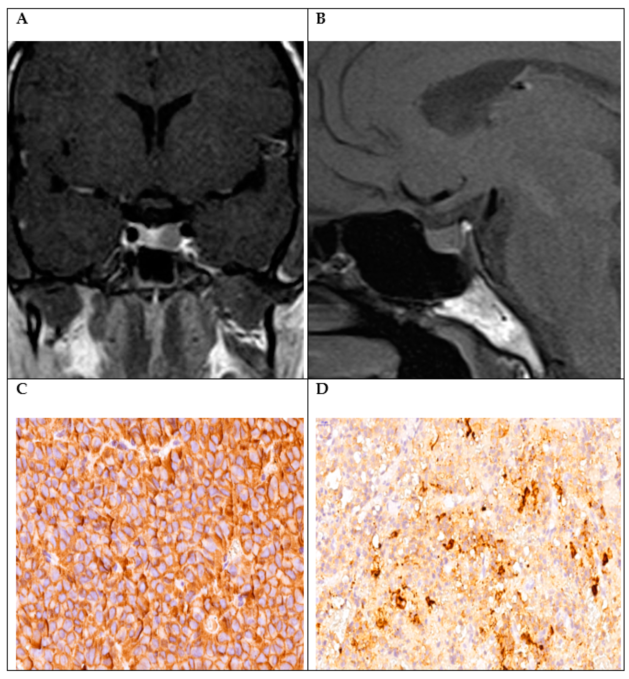 Diagnostics 14 00170 g002