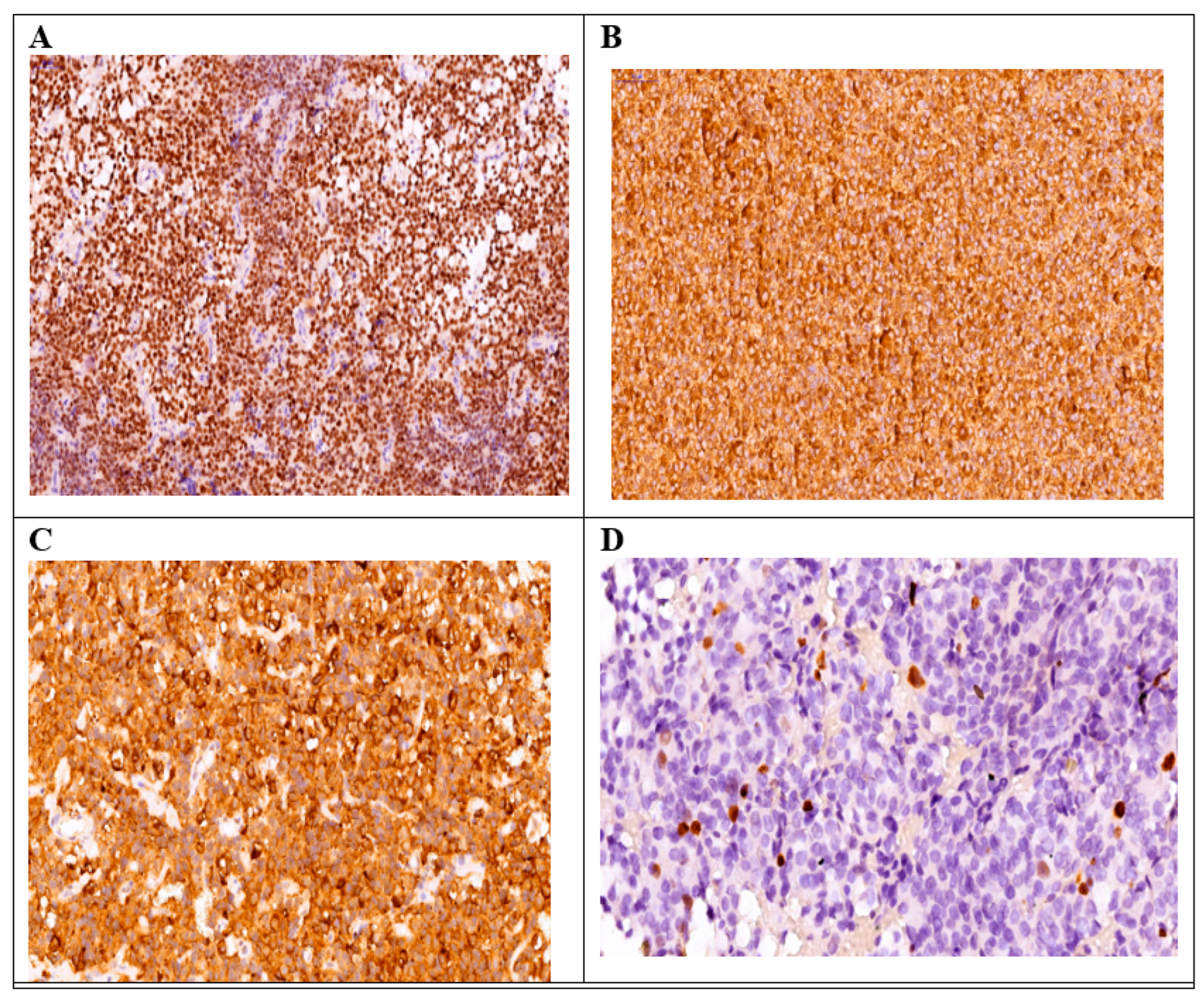 Diagnostics 14 00170 g004