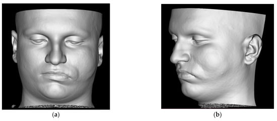 Diagnostics 14 00176 g001a