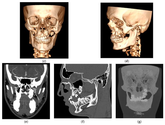 Diagnostics 14 00176 g001b