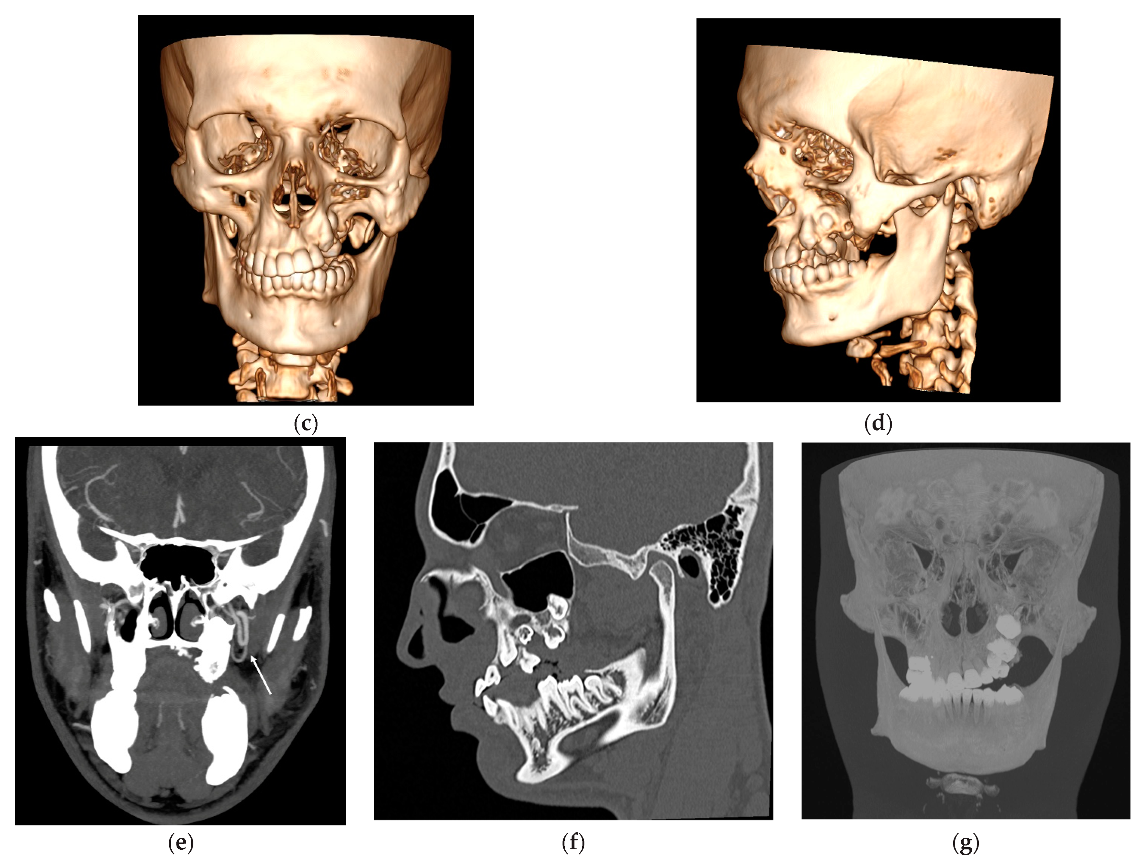 Diagnostics 14 00176 g001b