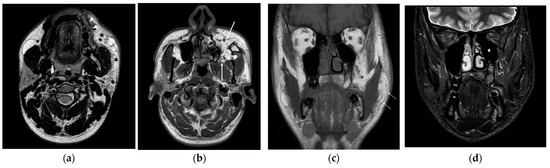 Diagnostics 14 00176 g002