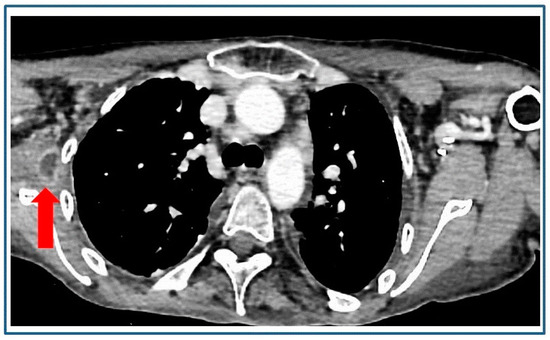 Diagnostics 14 00180 g001