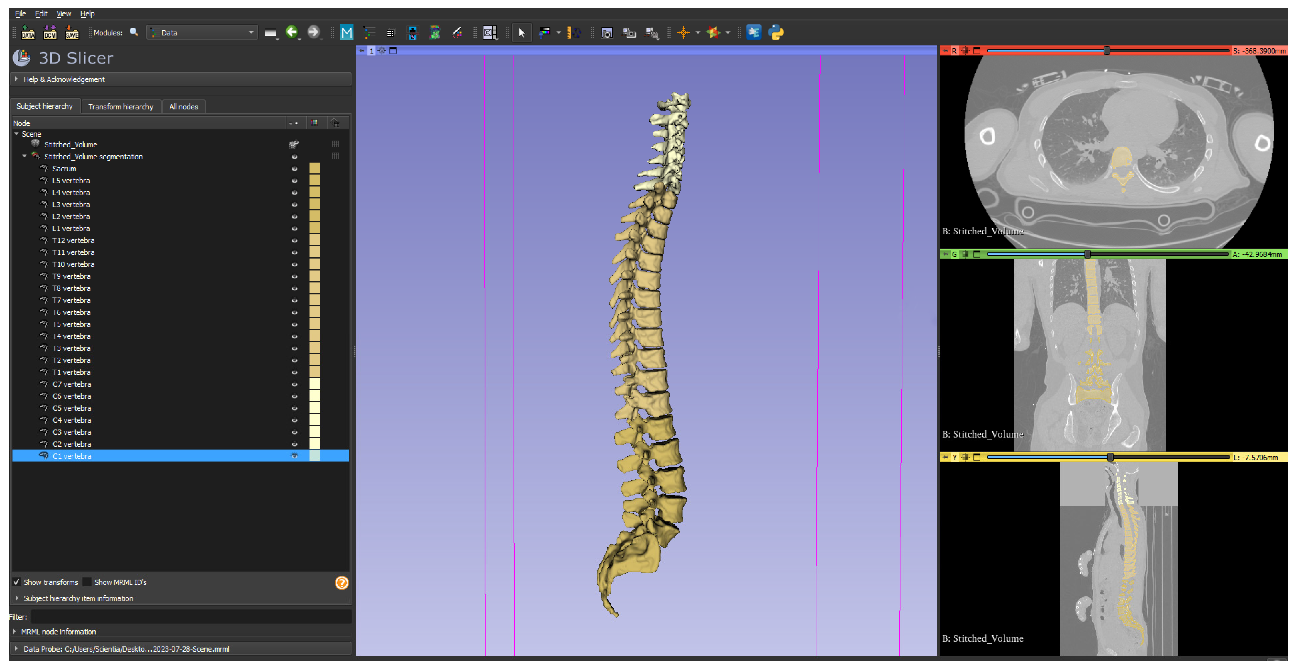 Diagnostics 14 00185 g001