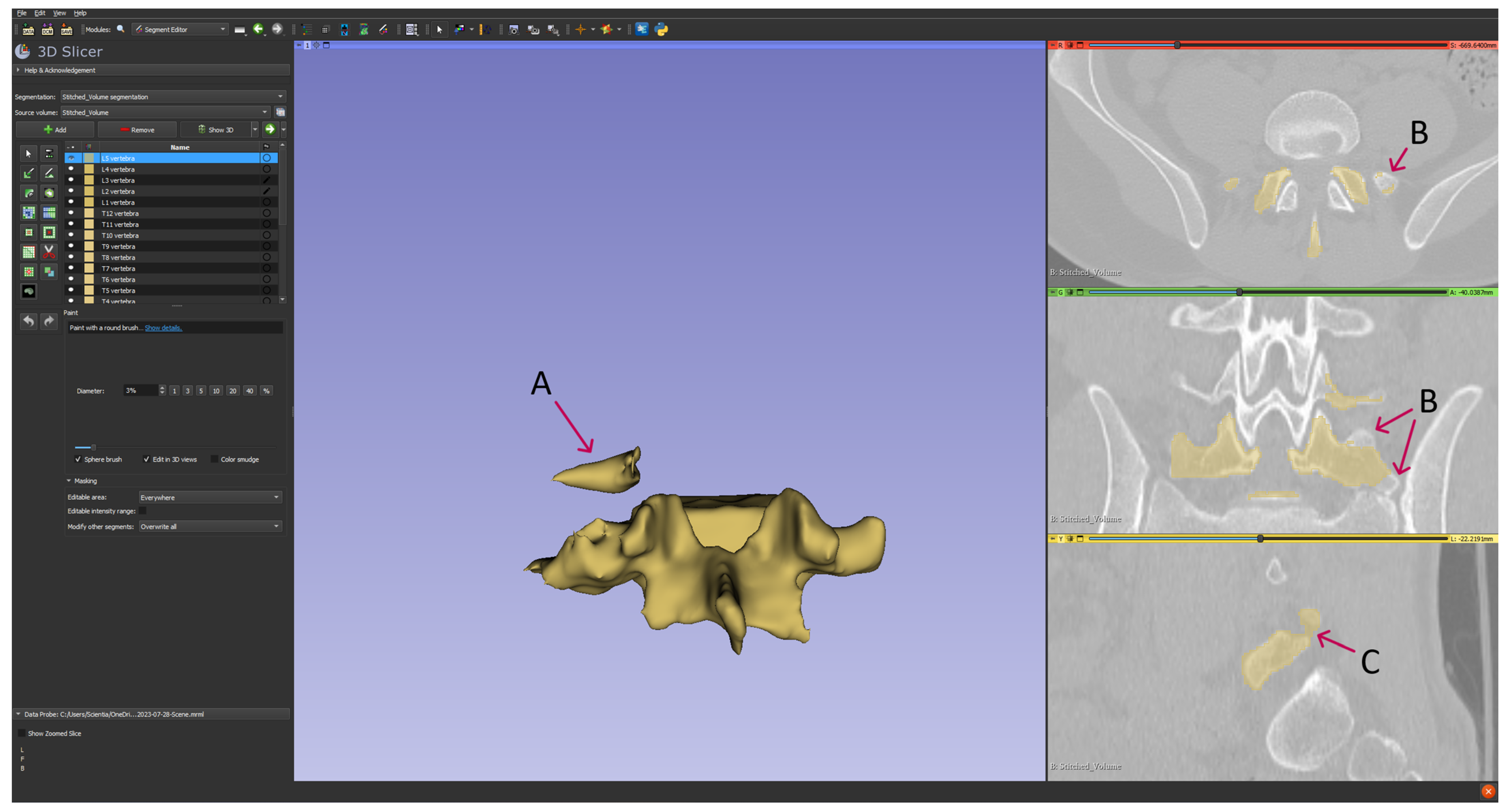 Diagnostics 14 00185 g003