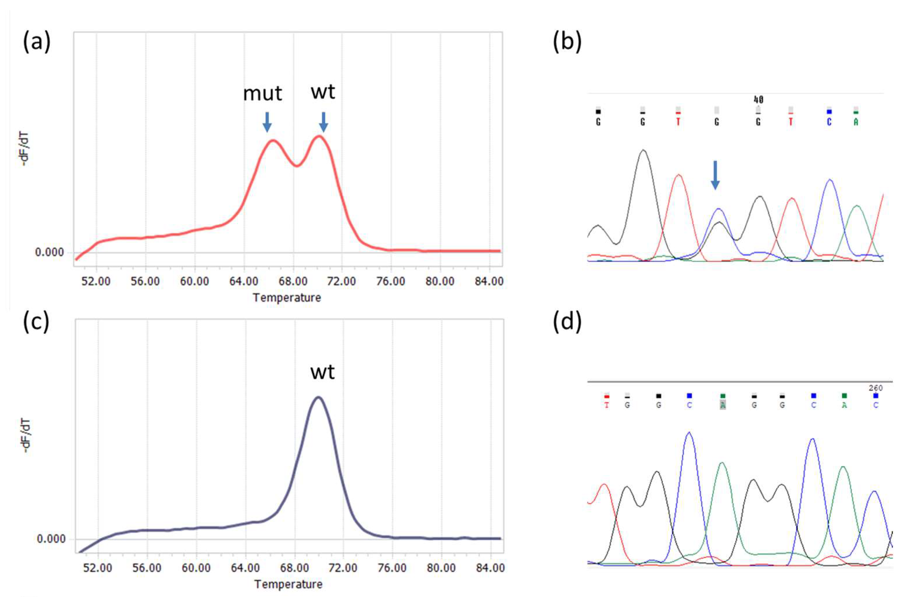 Diagnostics 14 00200 g001